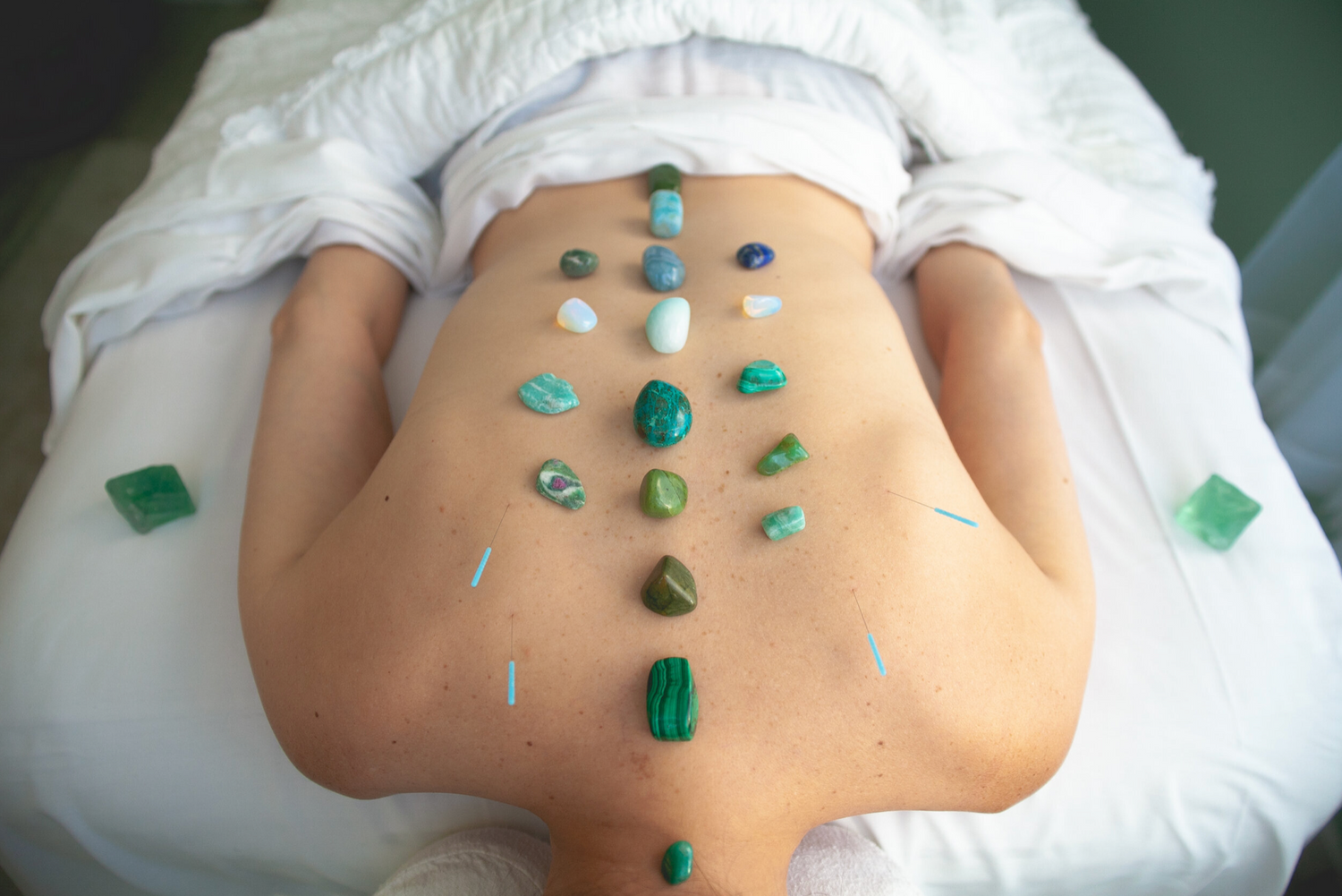 Healing crystals and stones arranged in a pattern on a person's abdomen during a therapy session.
