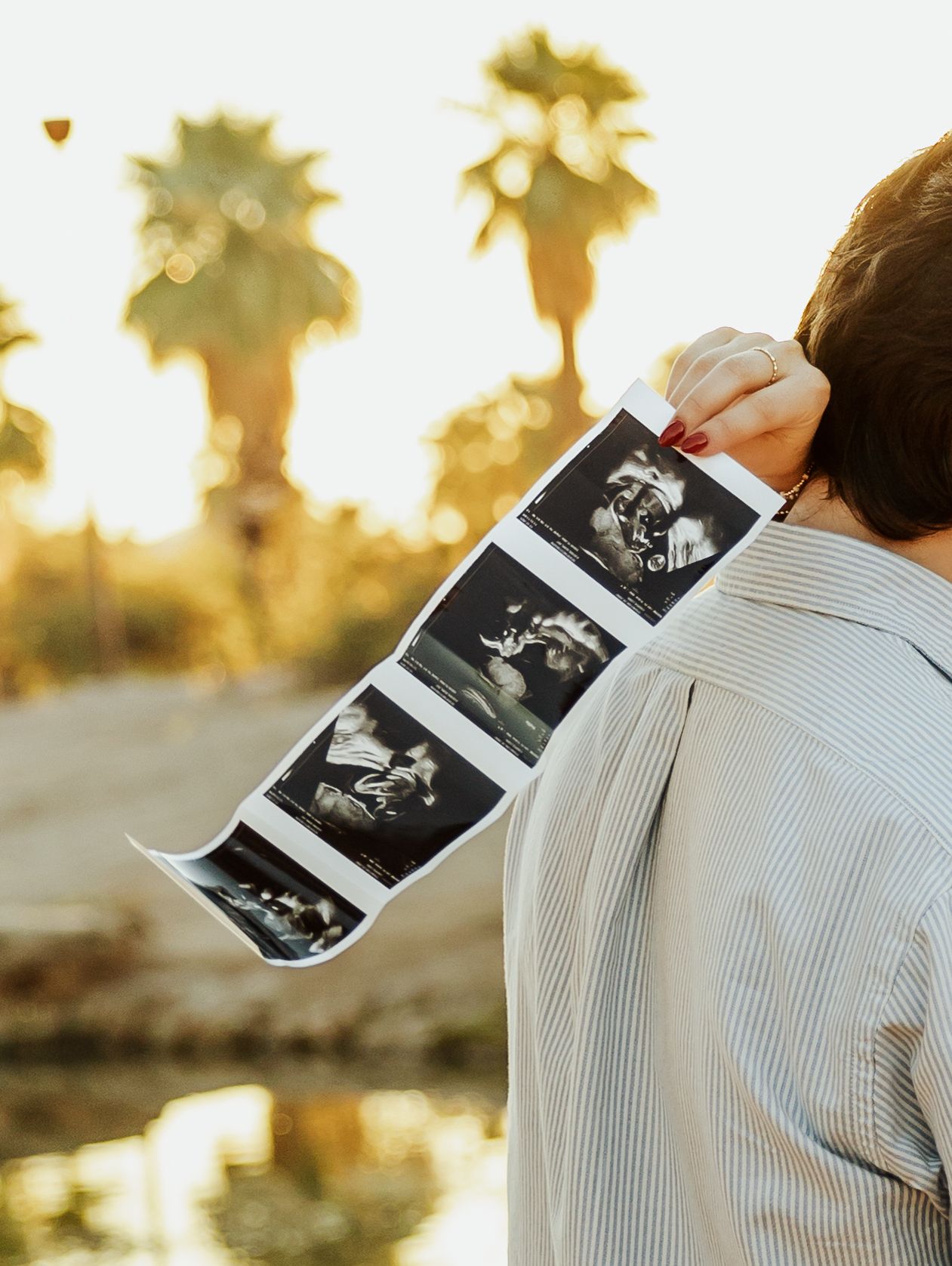 Person in striped shirt holds ultrasound photo at sunset with palm trees silhouetted in golden light.
