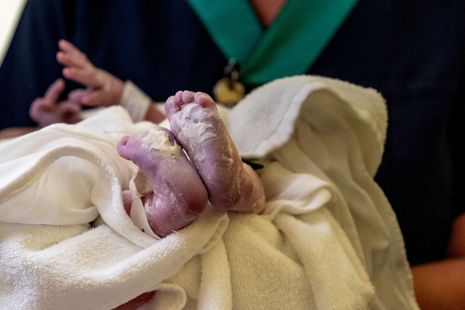 Close-up of a newborn baby's tiny feet wrapped in a white hospital towel after birth.