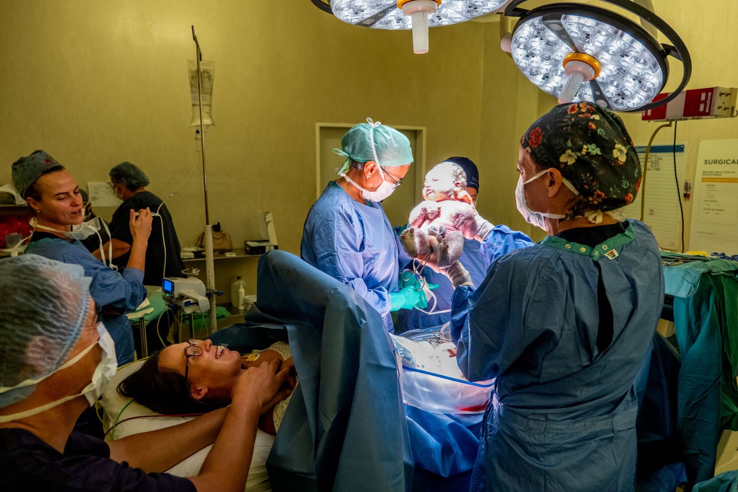 Medical team performing a cesarean section delivery under bright surgical lights in an operating room.