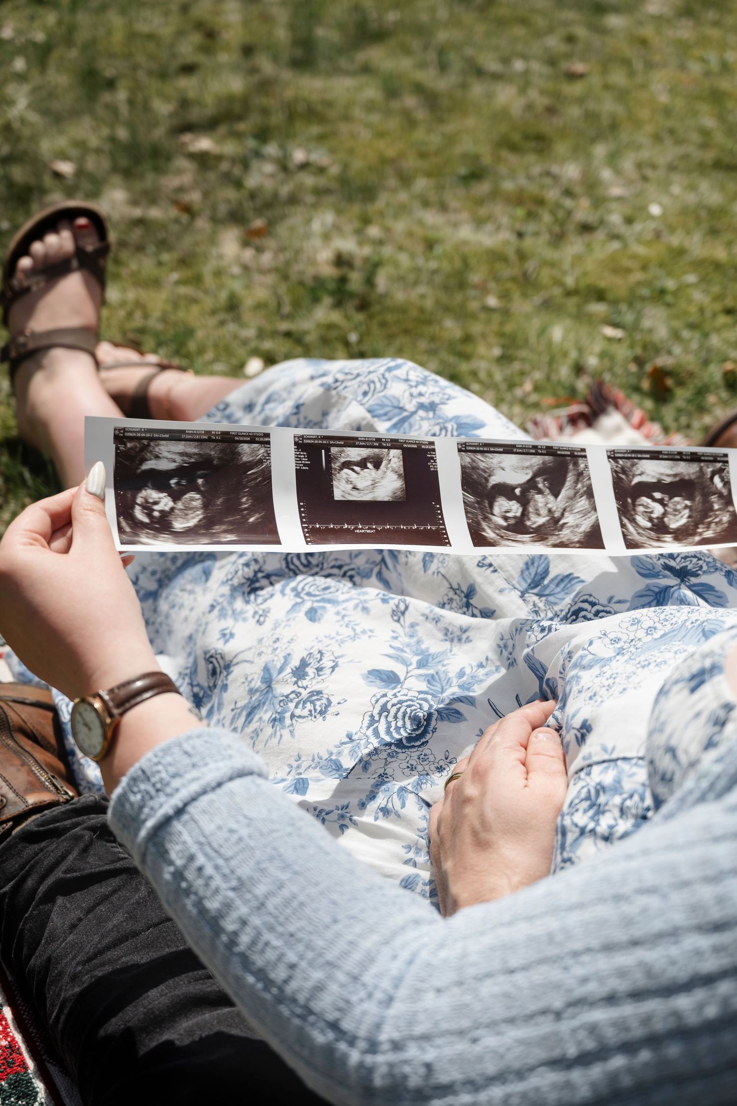Pregnant woman sitting outdoors on grass, holding ultrasound sonogram photos on her baby bump in floral maternity dress.