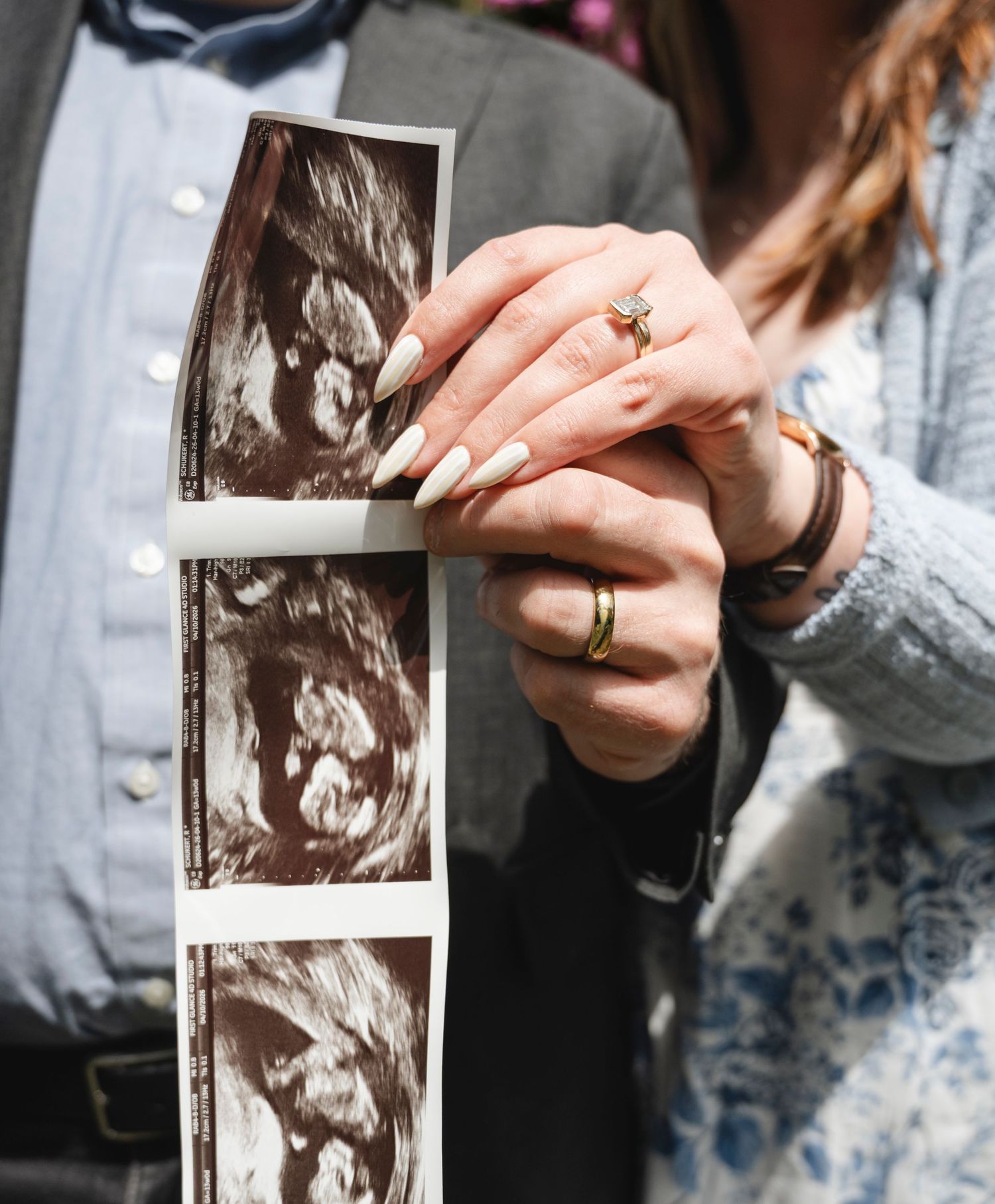 Couple holding ultrasound photos showing baby scans, woman wearing engagement ring and bracelet, pregnancy announcement.