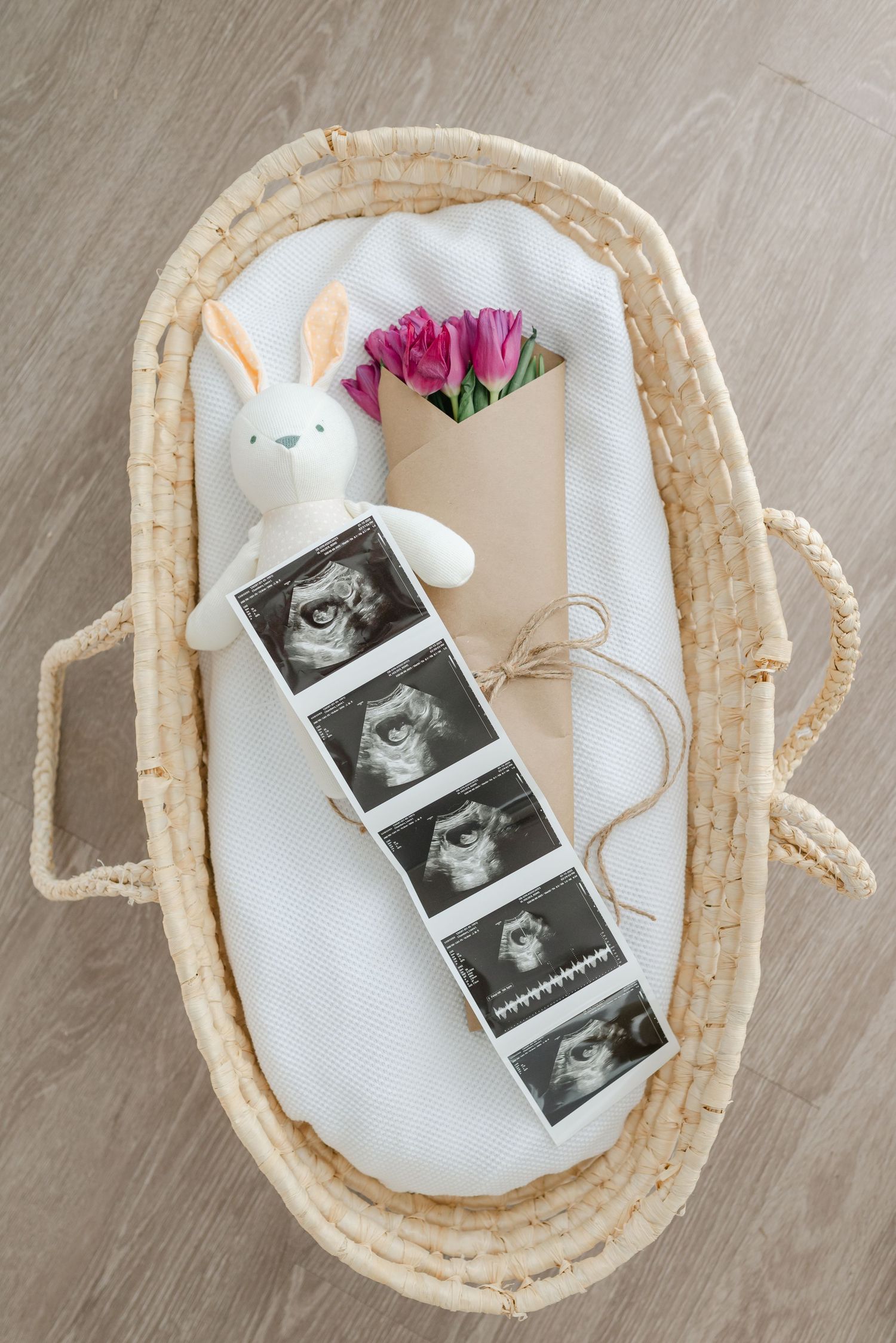 A series of ultrasound photos arranged in a basket with a white plush bunny and pink flowers showing a pregnancy announcement.