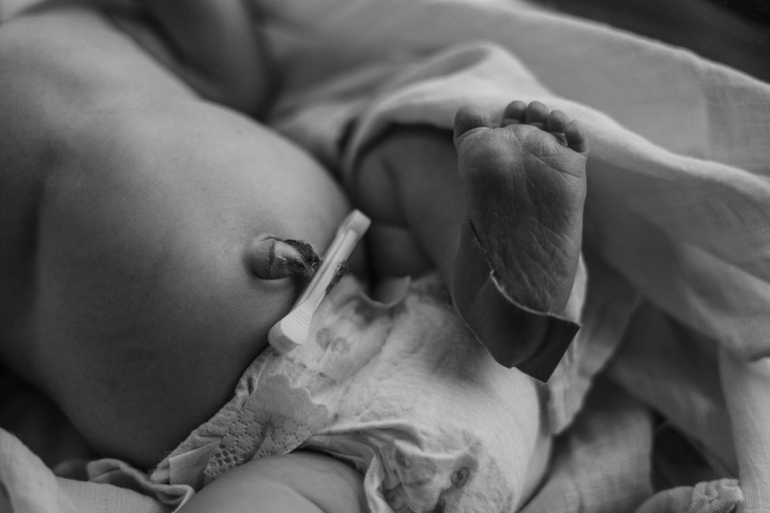 Close-up view of a surgical procedure being performed with gloved hands and medical instruments in a sterile setting.