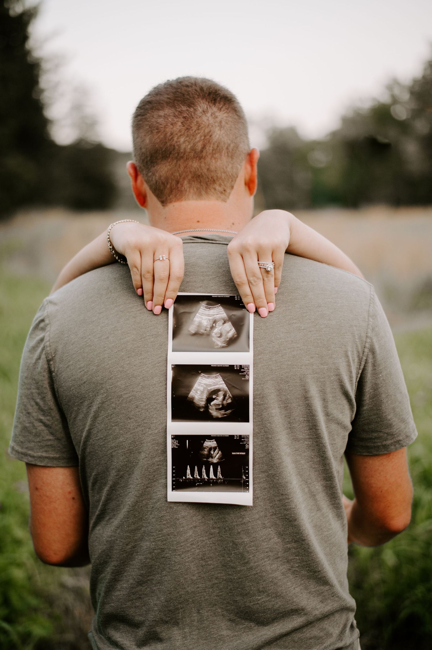 A series of ultrasound photos being held against a person wearing a gray t-shirt outdoors.