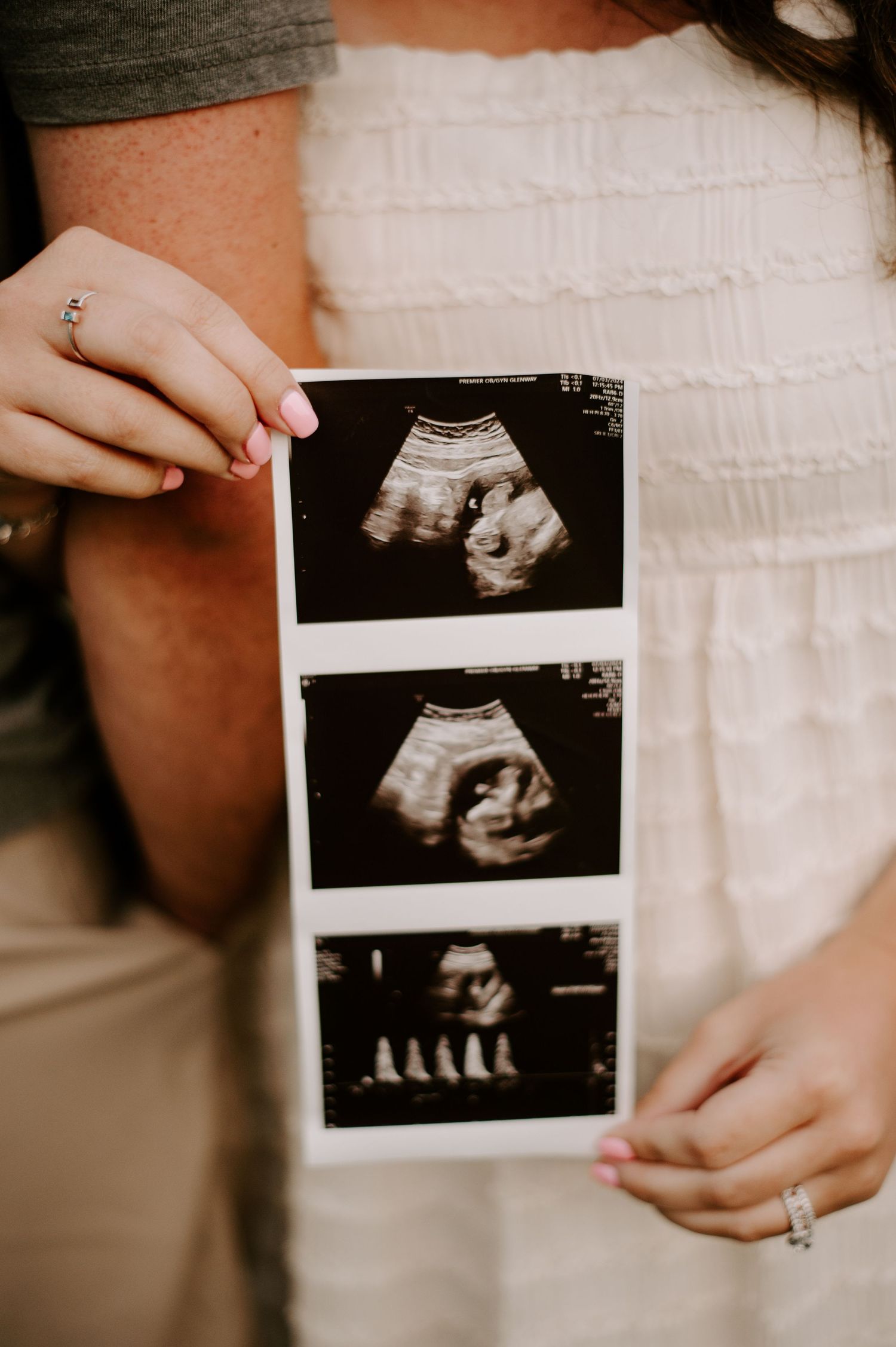 Hands holding a series of black and white ultrasound scan photos showing the development of an unborn baby.