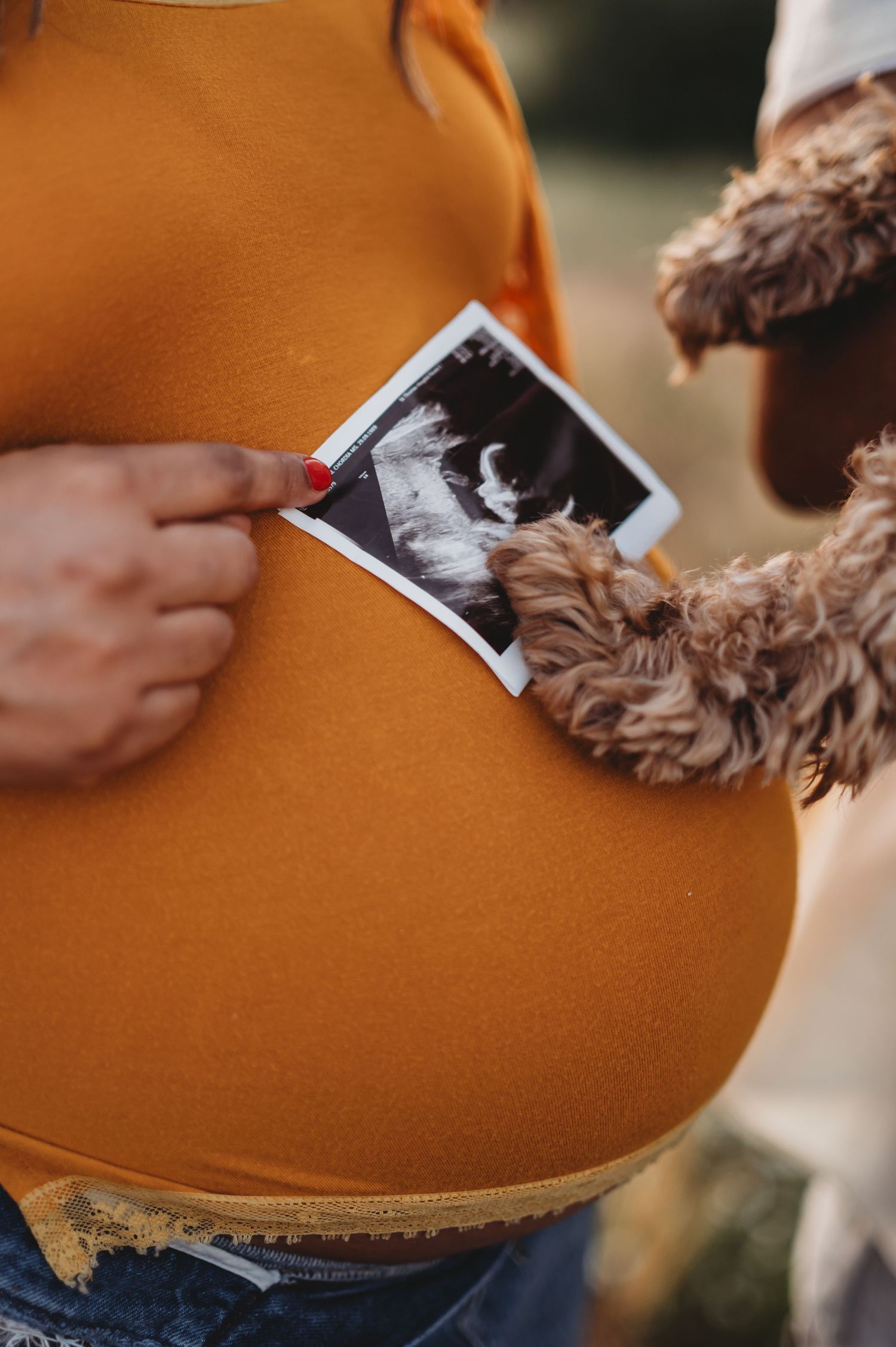 Pregnant woman in orange top holds ultrasound photo against her baby bump outdoors.