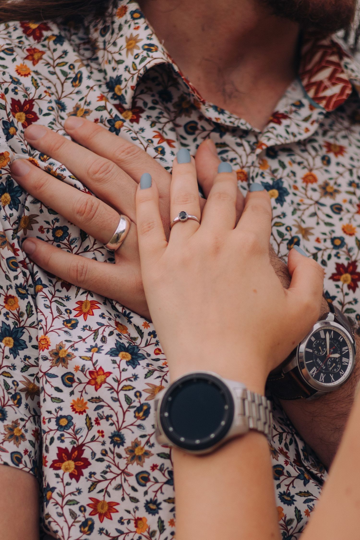 Close-up of couple's hands with rings and watches resting on floral patterned shirt.