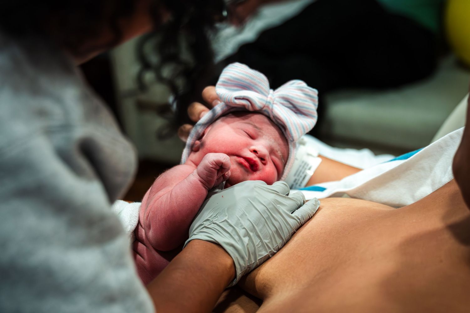 Newborn baby crying immediately after birth with bright red skin tone.