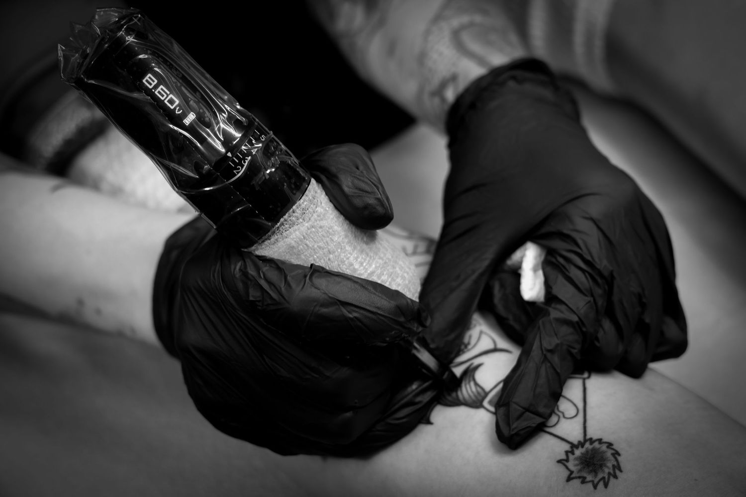 A series of black and white images showing hands in black gloves performing medical or surgical procedures.