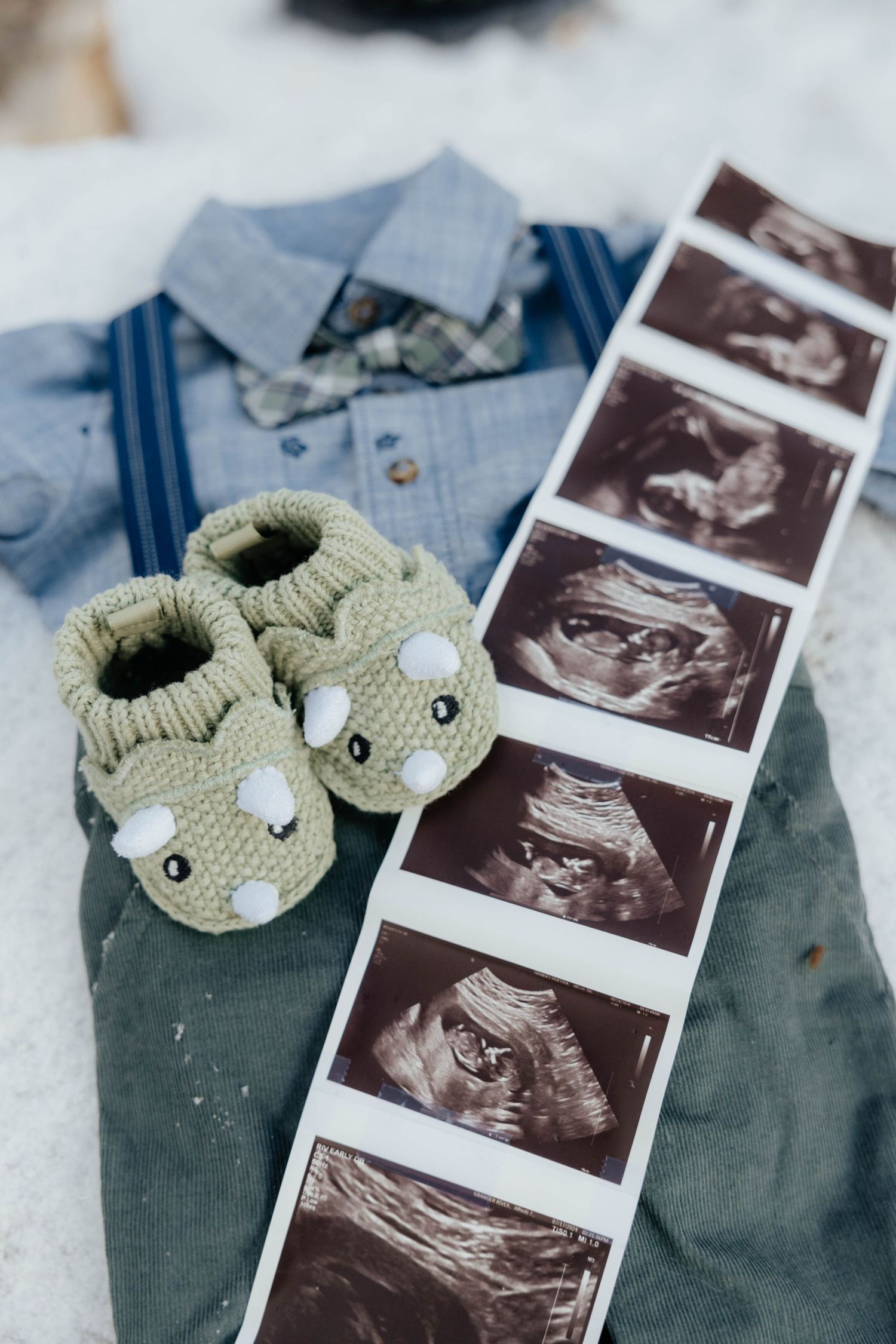 Ultrasound photos arranged next to small knitted baby booties and a blue shirt.