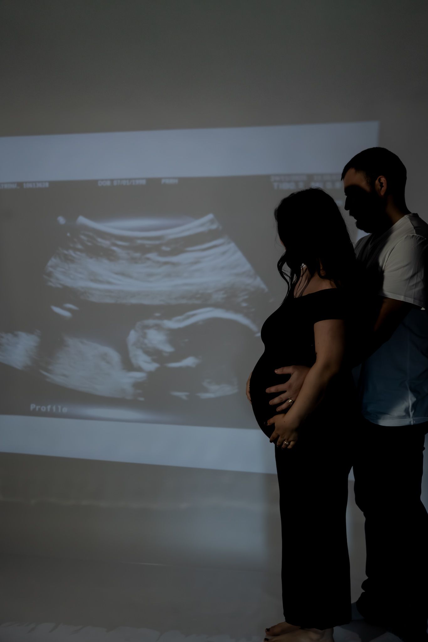 Expectant couple views ultrasound image projected on wall while embracing in dark room.