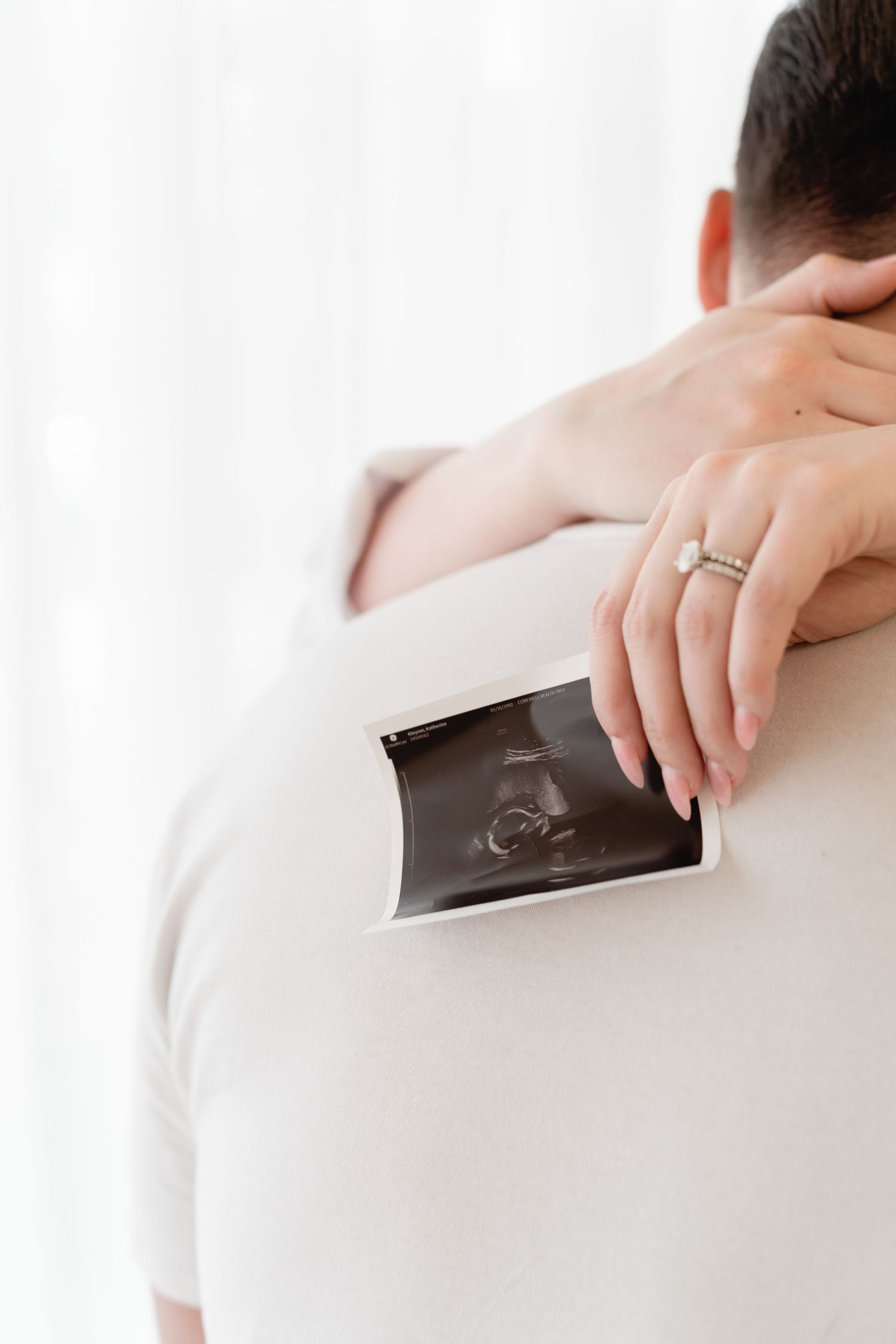 Woman holding ultrasound photo on mans shoulder while embracing, wearing engagement ring.