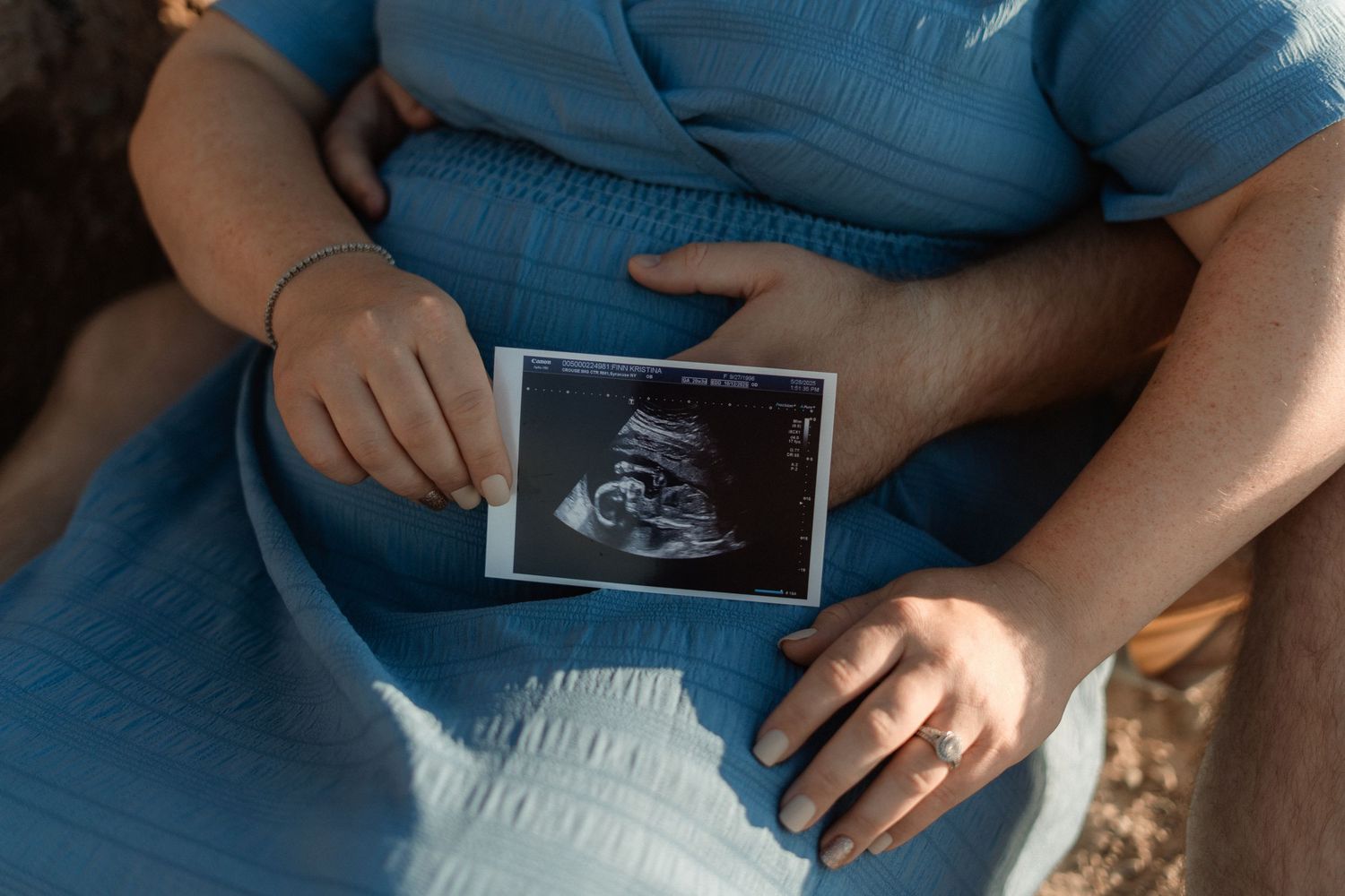 Person in blue clothing holding an ultrasound sonogram photo on their lap.