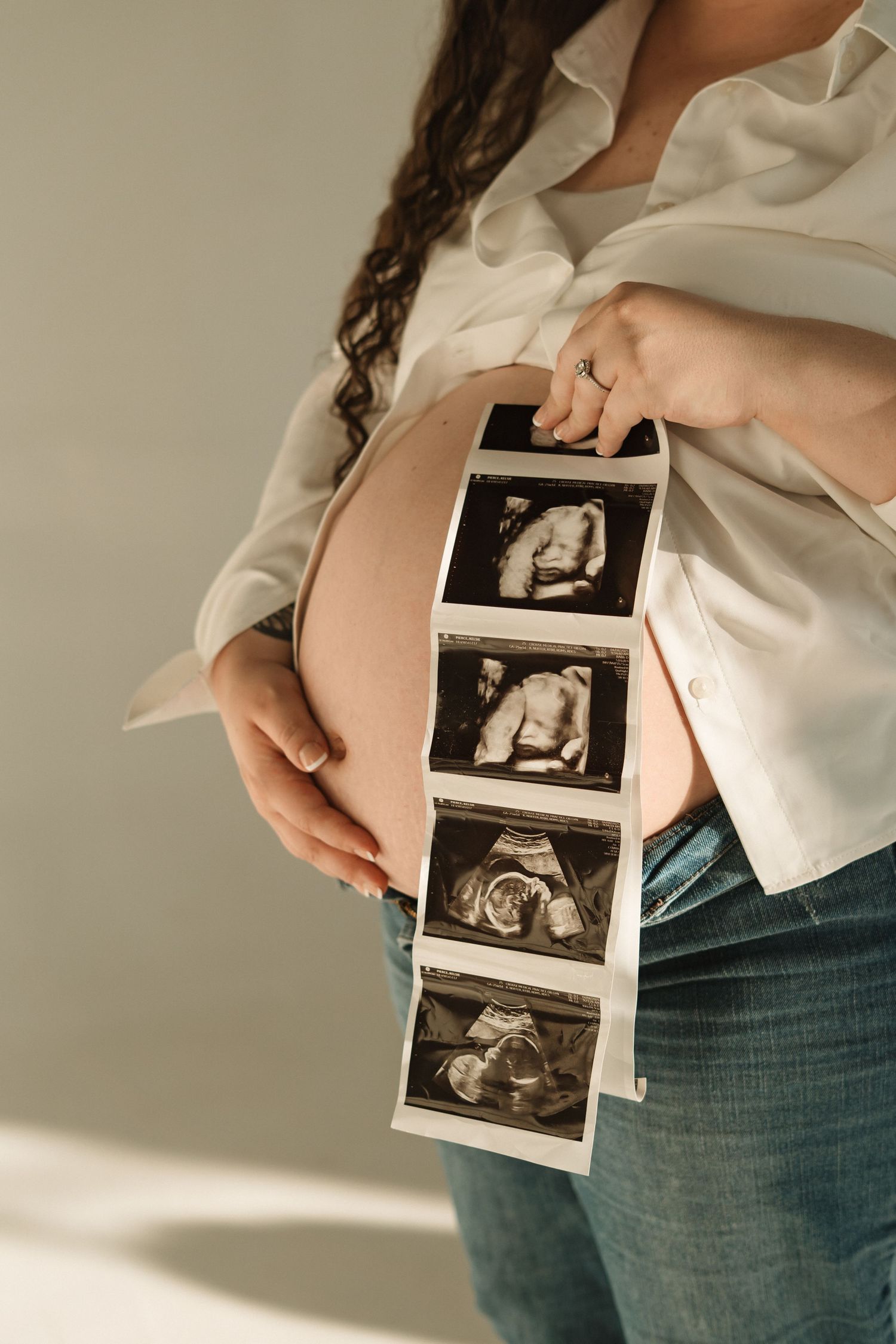 A series of ultrasound photos held against a person wearing jeans and a white top in natural lighting.