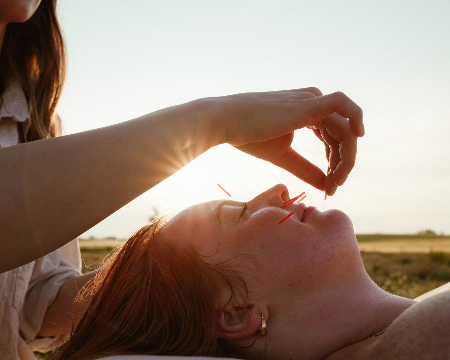 Acupuncturist placing needles on a woman's face during an outdoor golden hour treatment session.