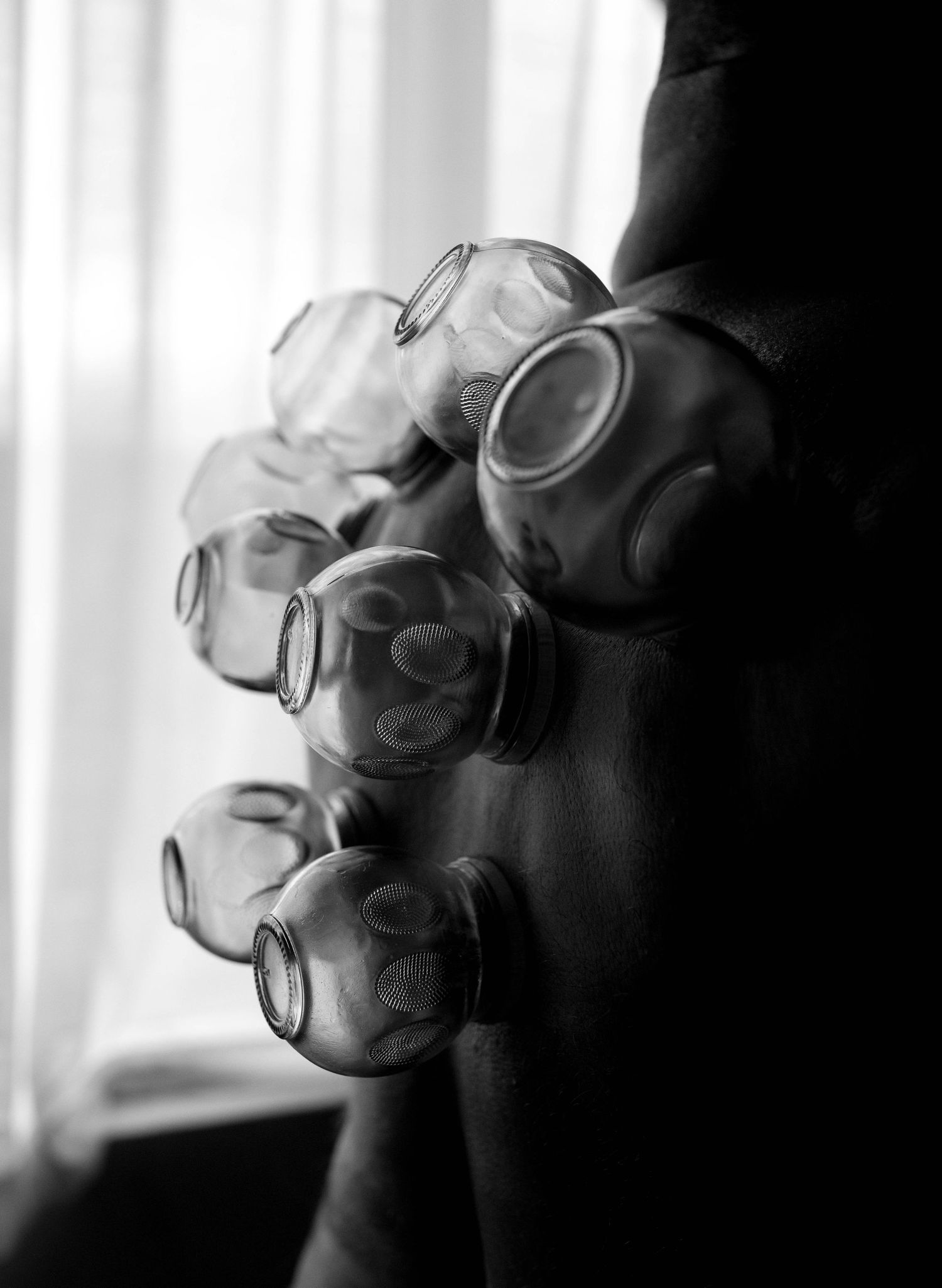 Black and white photo of glass cupping therapy jars attached to a person's back near a window.