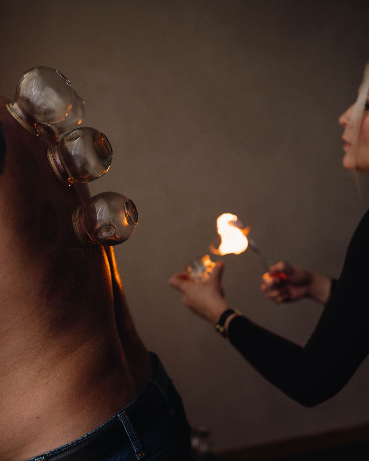 Therapist performing fire cupping therapy on a patient's back with glass cups in a dimly lit studio.