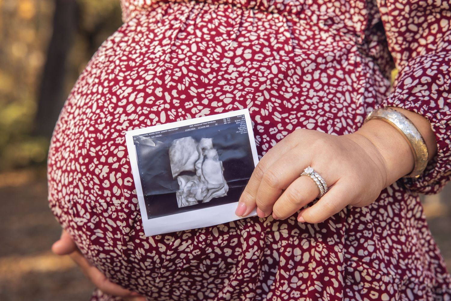 Hands hold vintage-style photographs against floral print fabric background.
