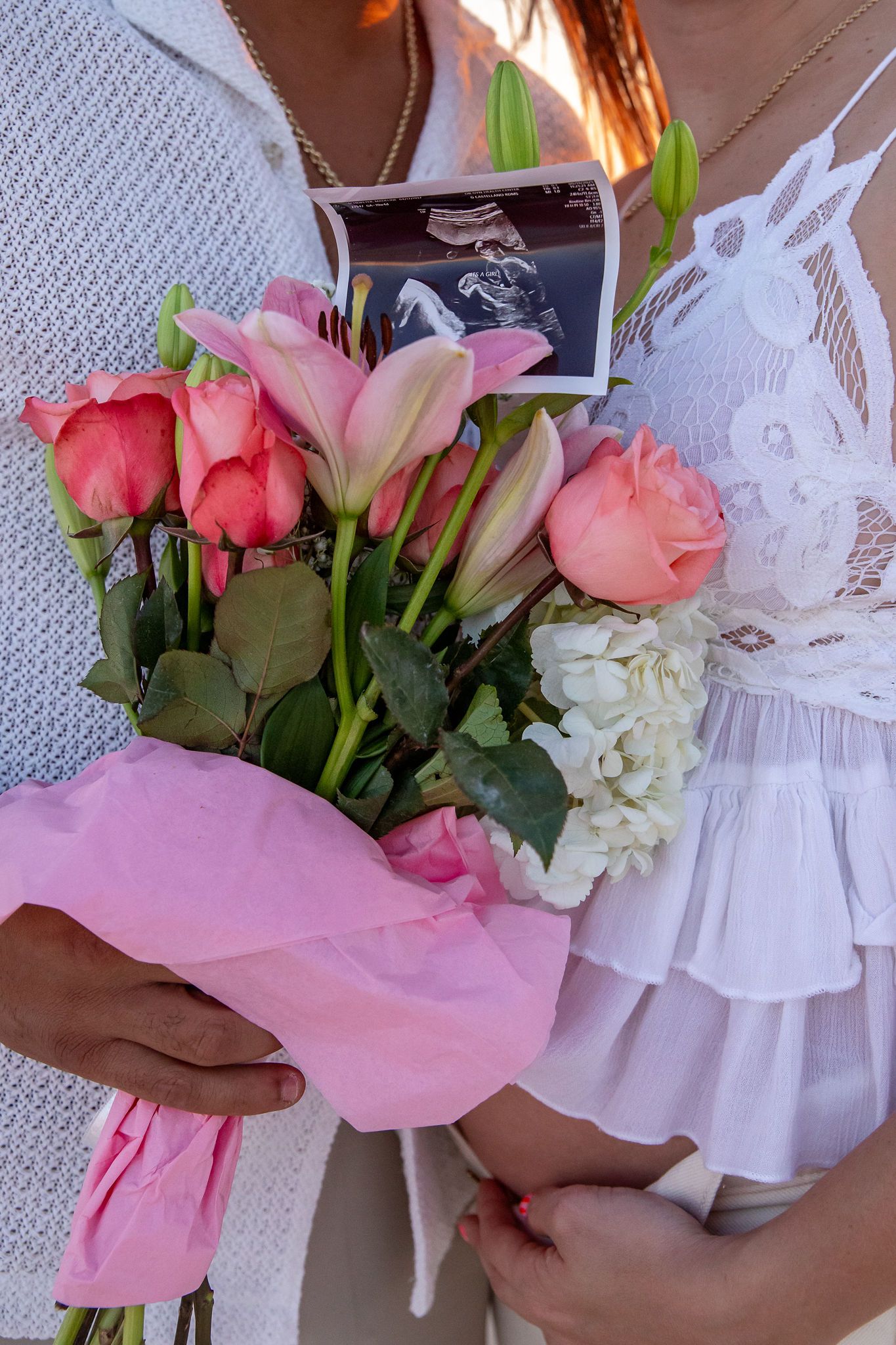 Close up of pink and white flower bouquet with ultrasound photo.