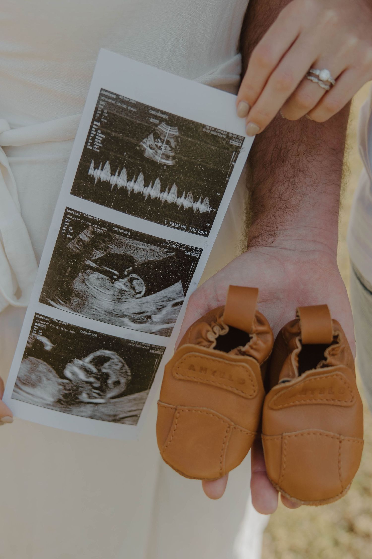 Pregnancy reveal photoshoot
