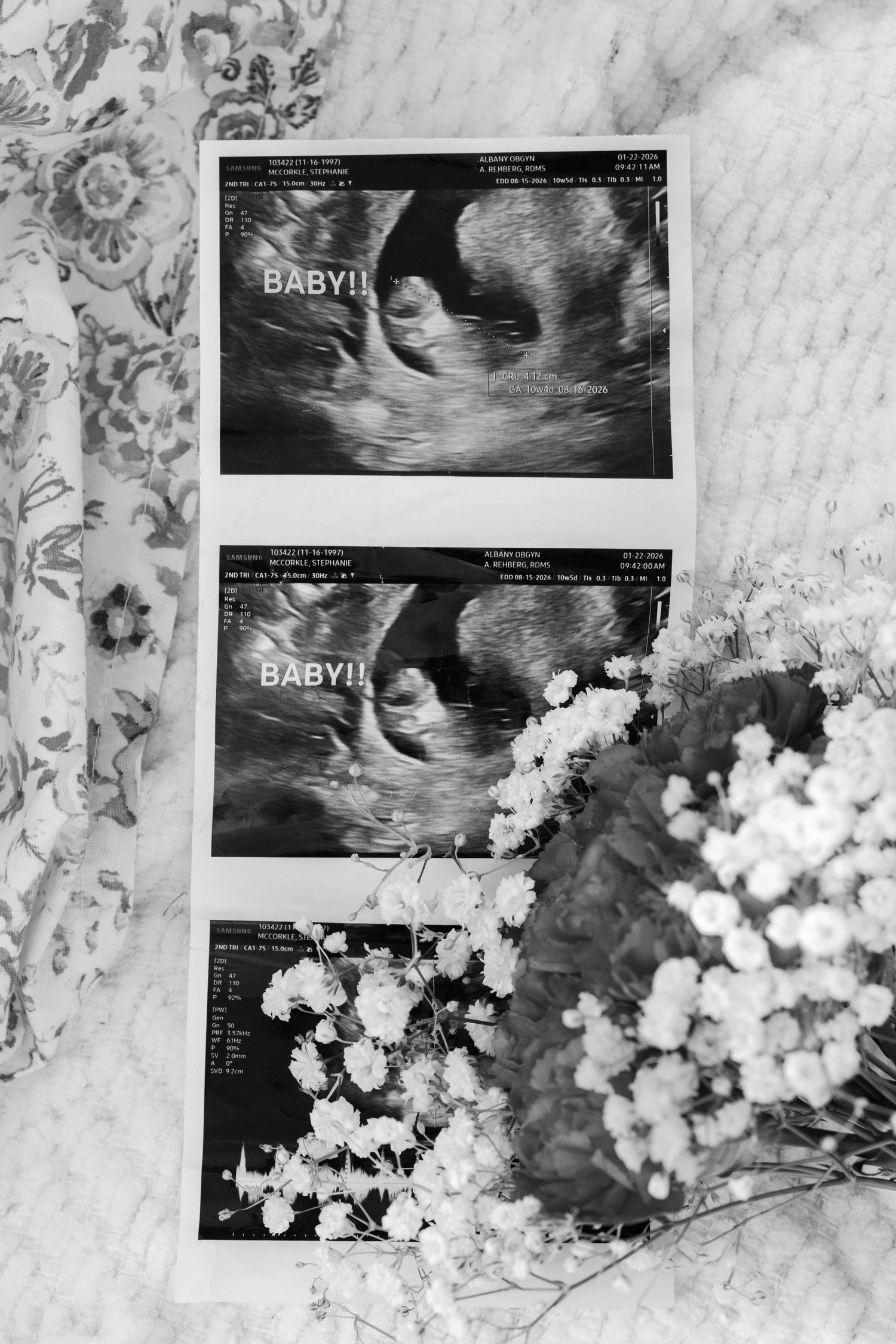 Black and white baby ultrasound photos with white flowers in elegant flat lay.