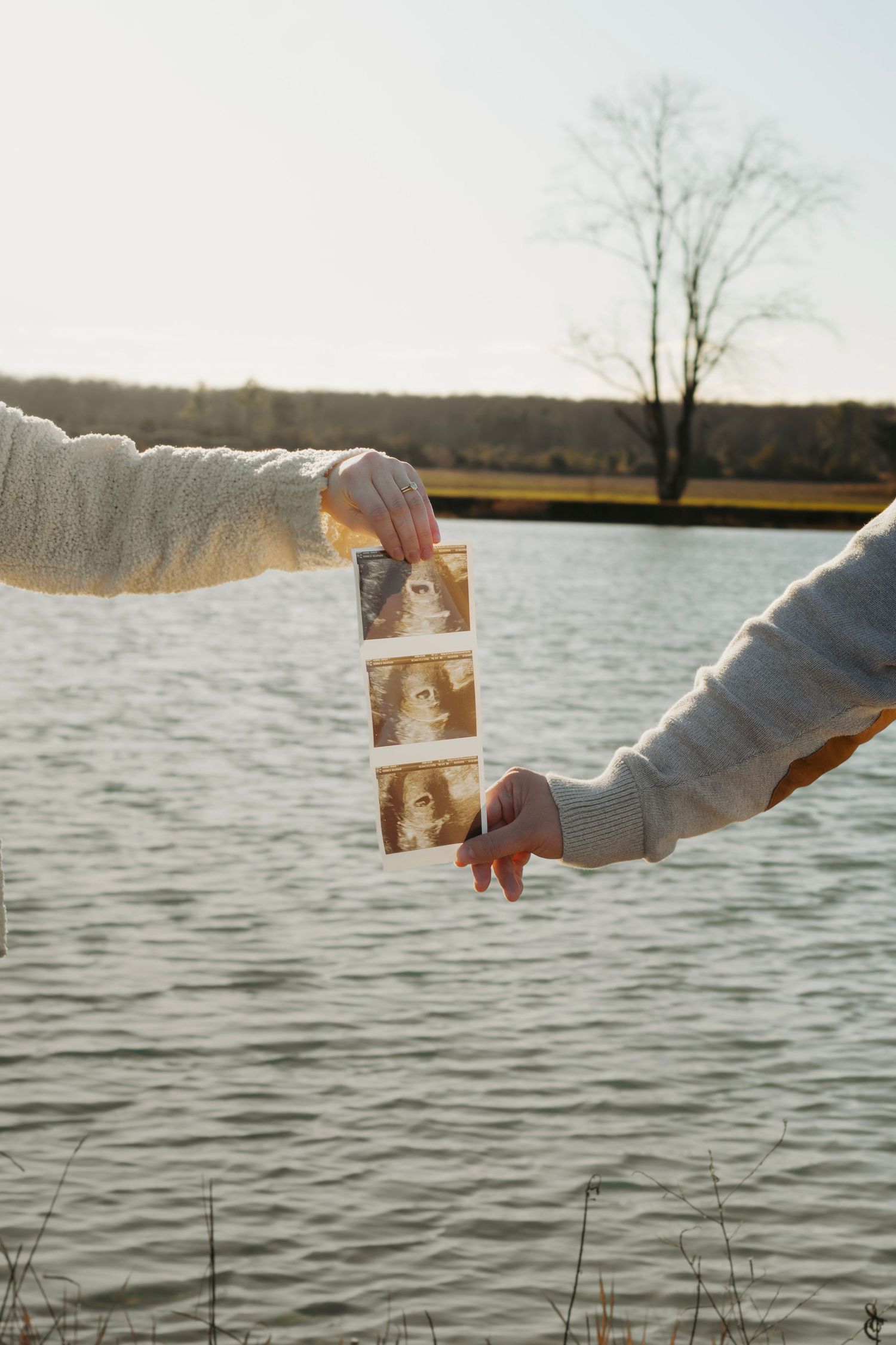 Two hands holding ultrasound strip photos by a sunlit lake.