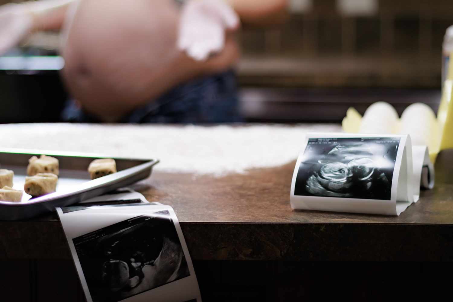 Ultrasound photos displayed on a wooden table with a pregnant woman sitting in the background.