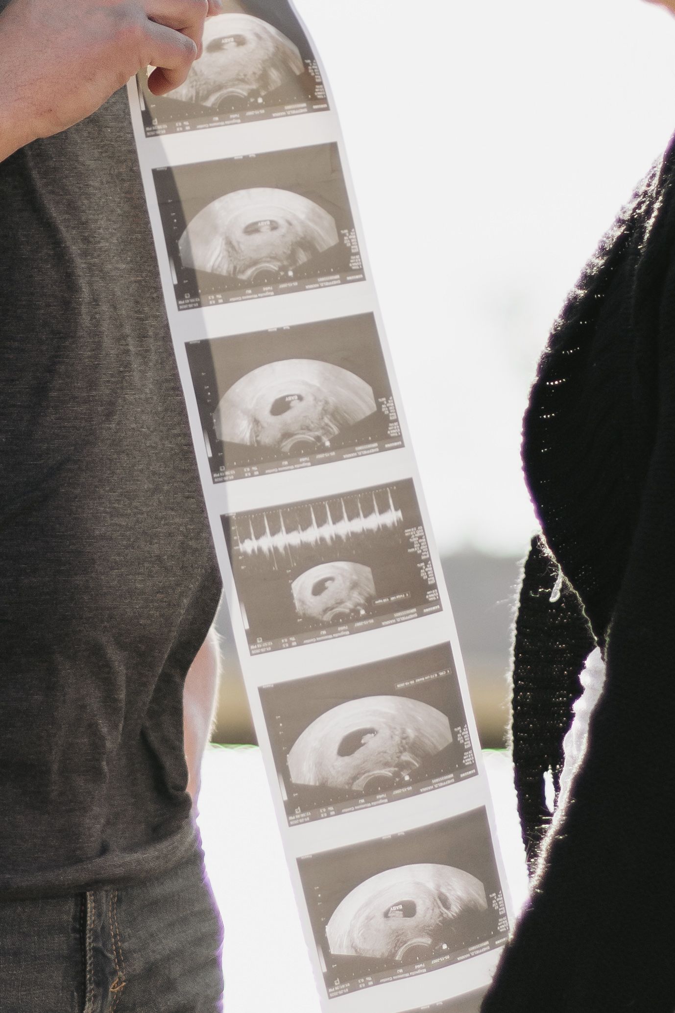Expectant couple holds ultrasound photo strip showing baby images during outdoor pregnancy announcement session.