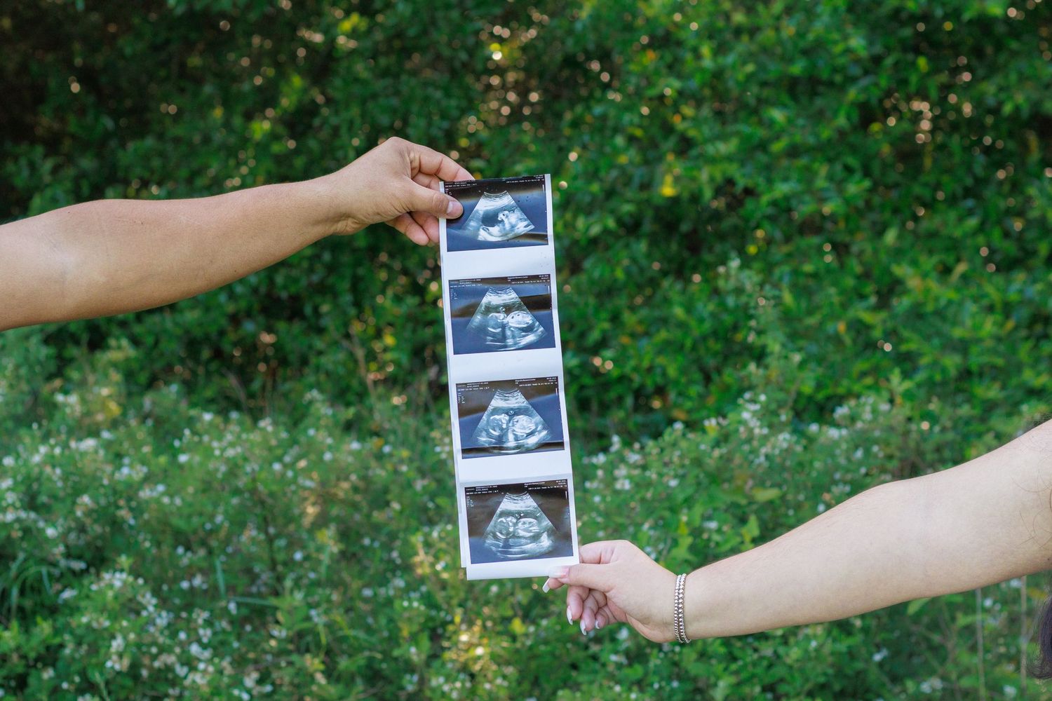 Two hands hold a strip of ultrasound photos together against a lush green leafy background.