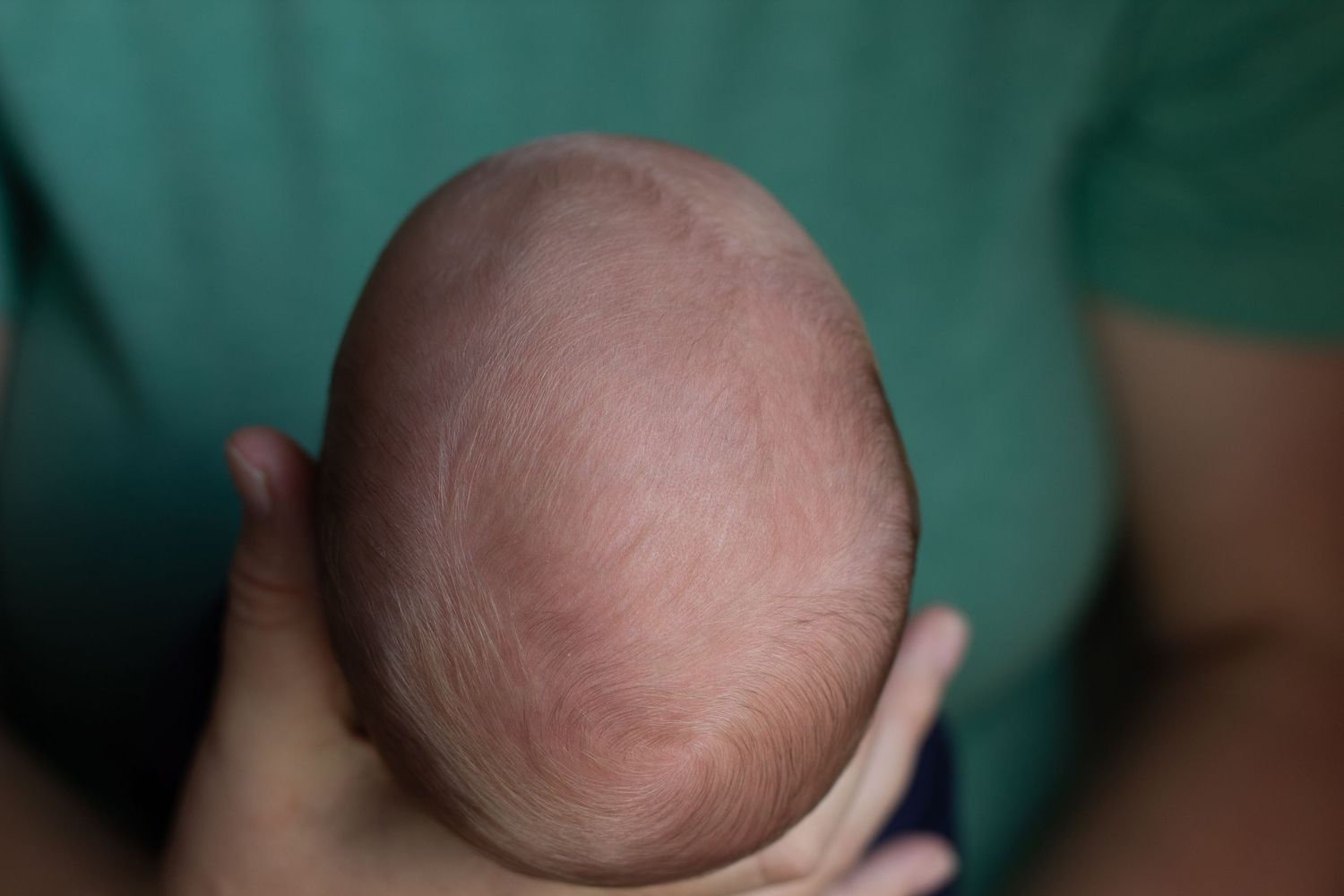 Close-up top view of a newborn baby's head showing delicate skin texture.