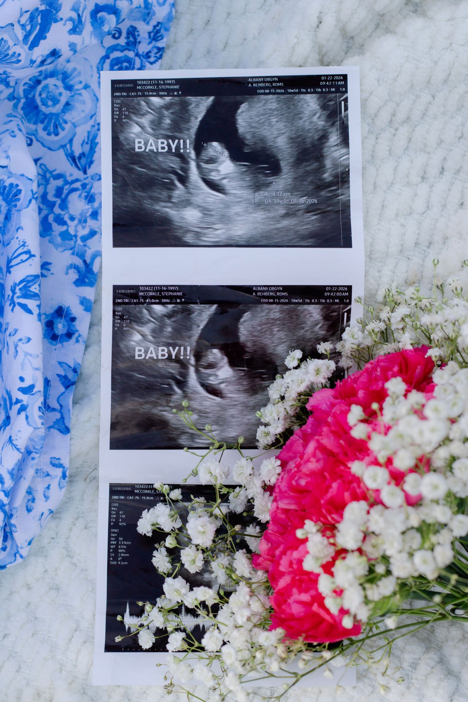 Baby ultrasound photos labeled BABY surrounded by pink flowers and floral fabric.