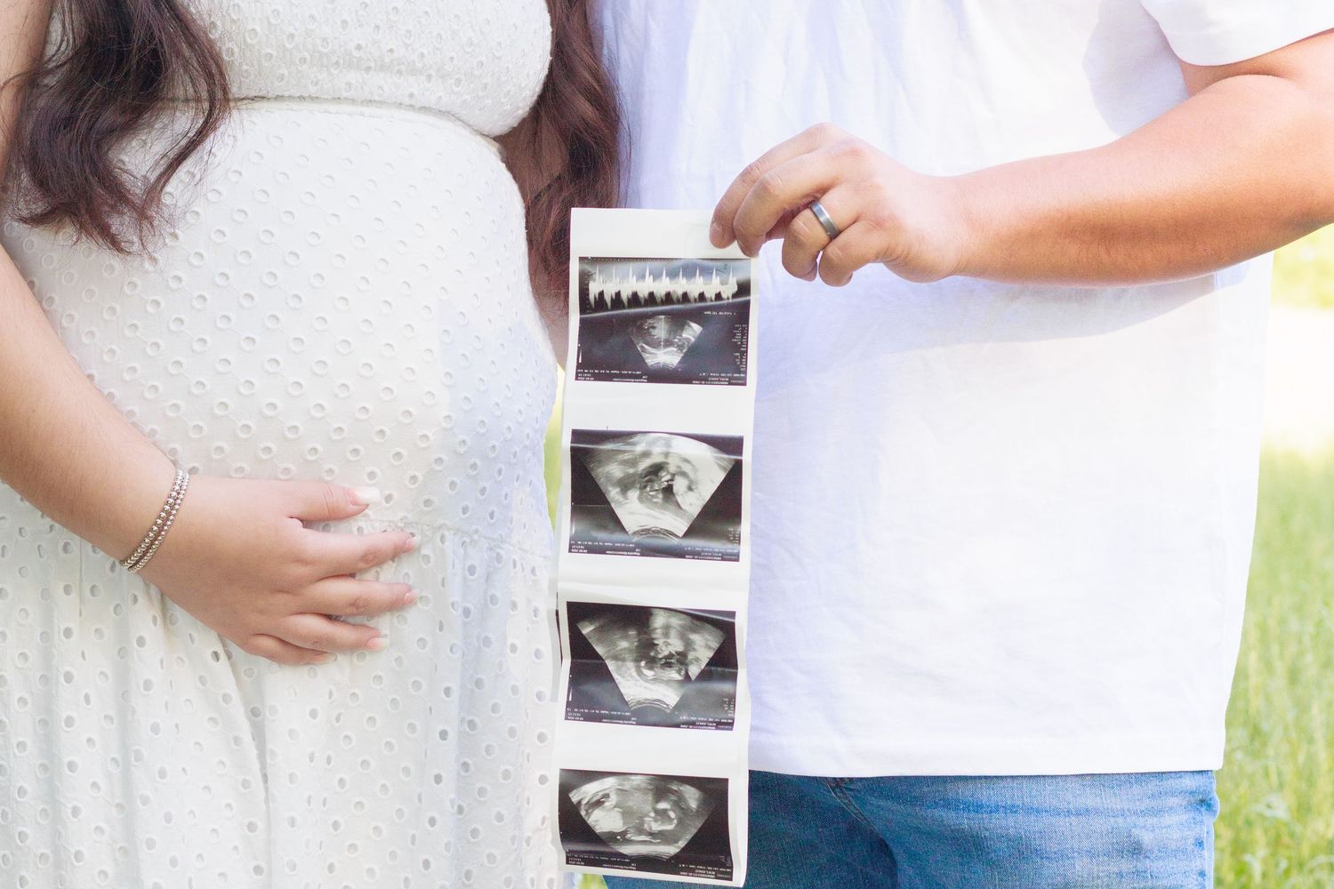 Pregnant woman in white dress and partner holding ultrasound photos outdoors in a field.