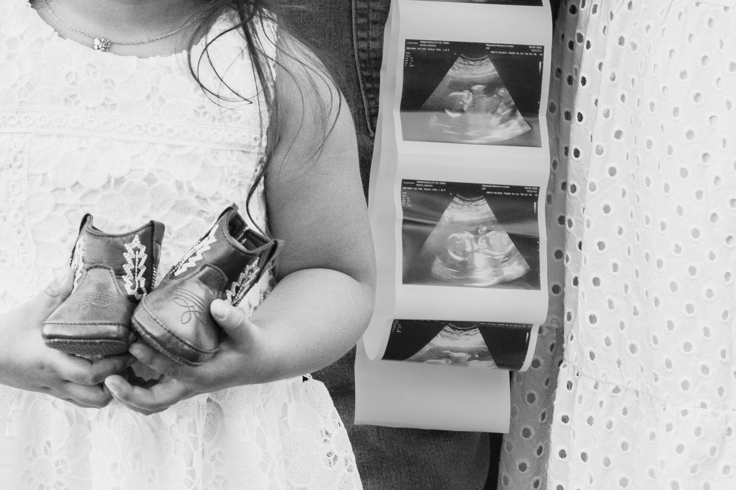 Black and white photo of young girl holding tiny baby boots beside ultrasound images.