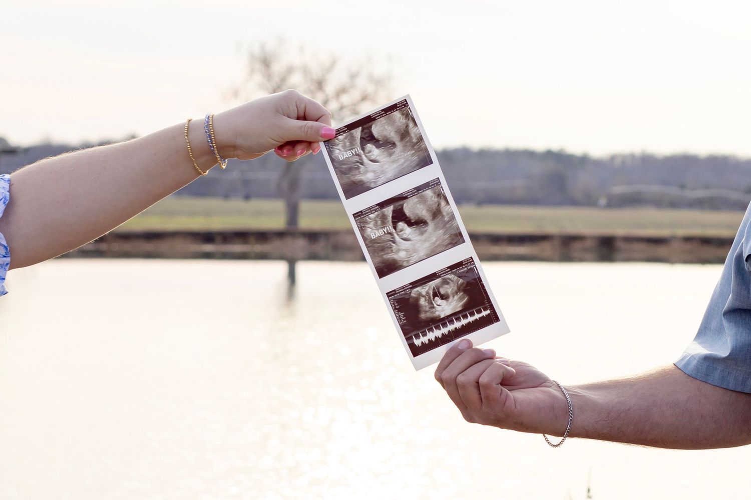 Couple holding ultrasound photos together by a lake in a pregnancy announcement photo.