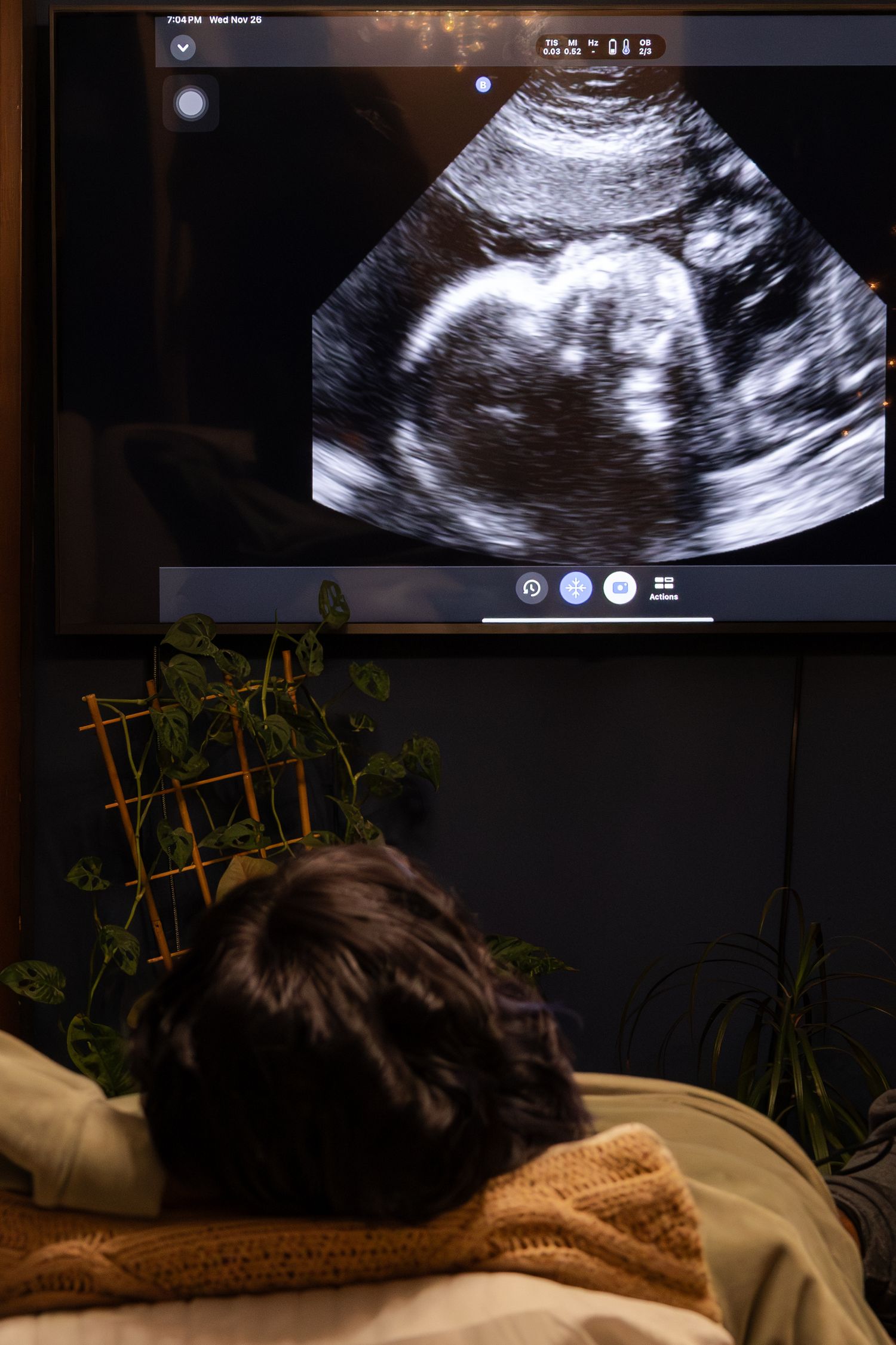 Pregnant woman lying down viewing ultrasound scan on large screen monitor in dark room in Winnipeg