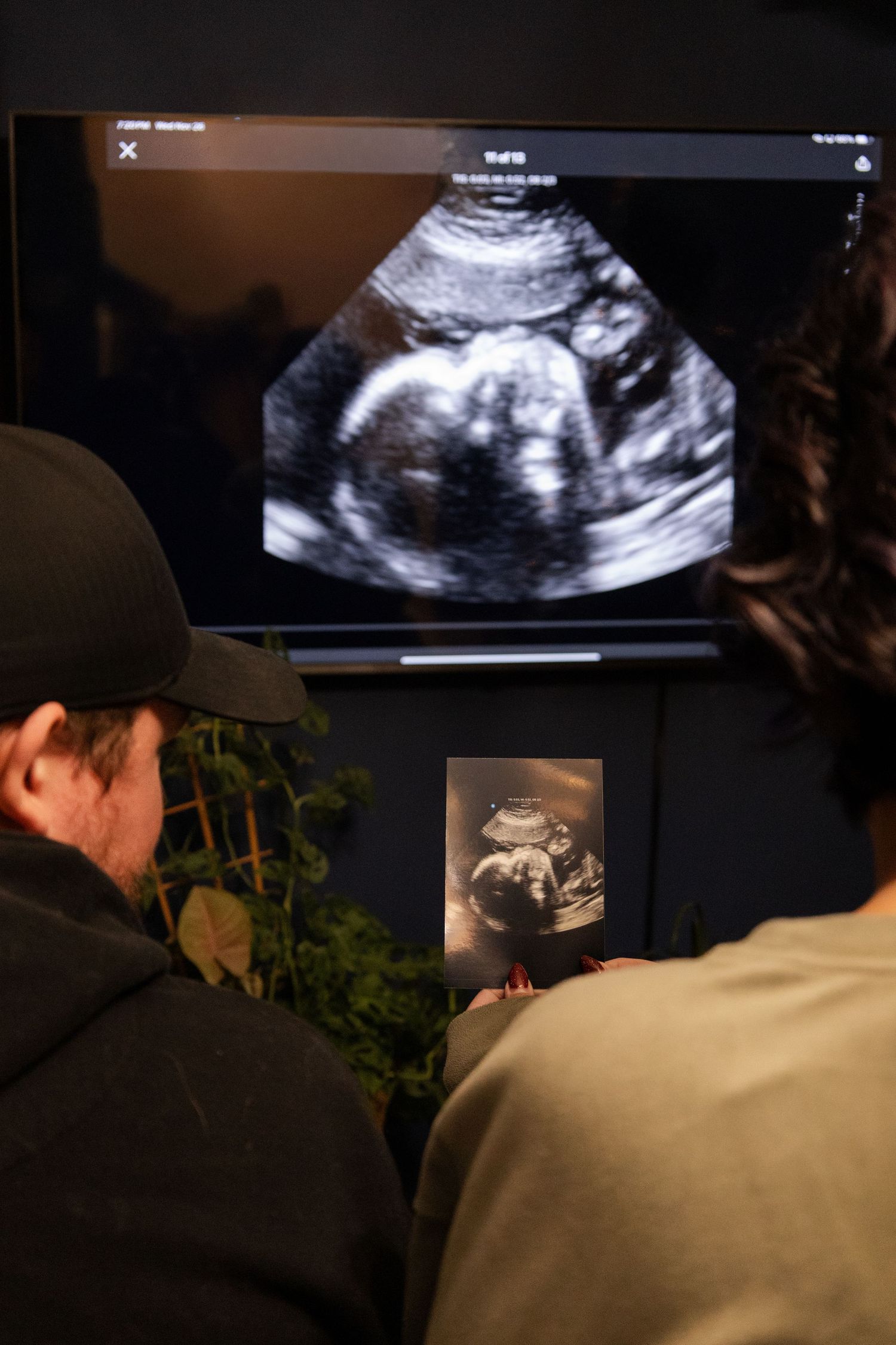 Couple viewing pregnancy ultrasound scan on large TV screen with printed sonogram photo below in Winnipeg