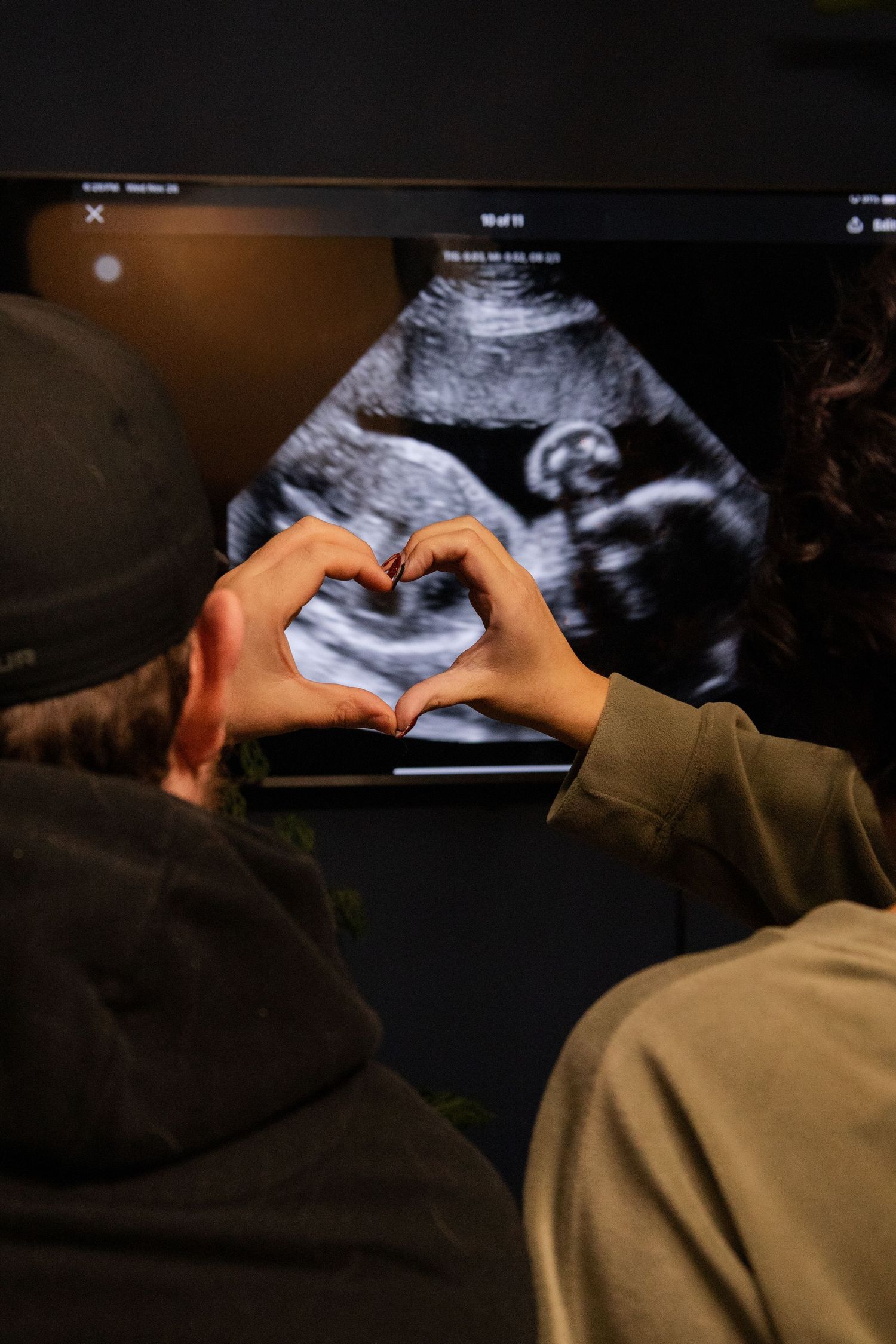 Couple making a heart shape with their hands in front of an ultrasound scan on a monitor in Winnipeg