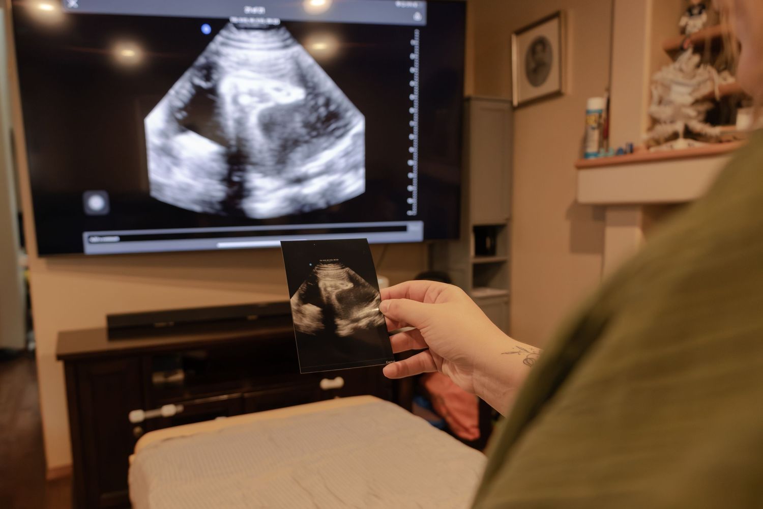 Person holding printed ultrasound photo with live baby scan displayed on large TV in background in Winnipeg