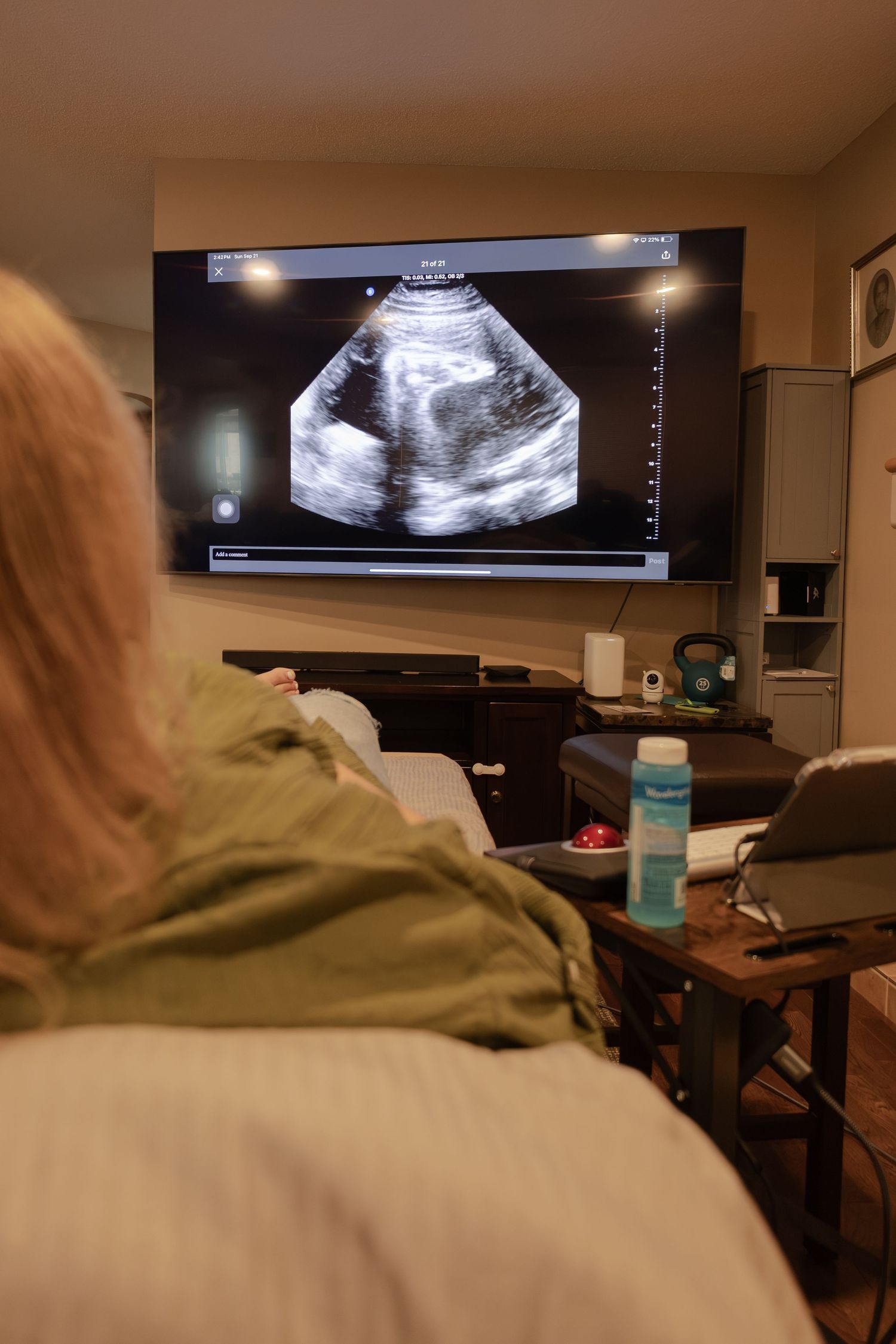 Pregnant woman viewing her baby's ultrasound image displayed on a large wall-mounted TV screen in Winnipeg