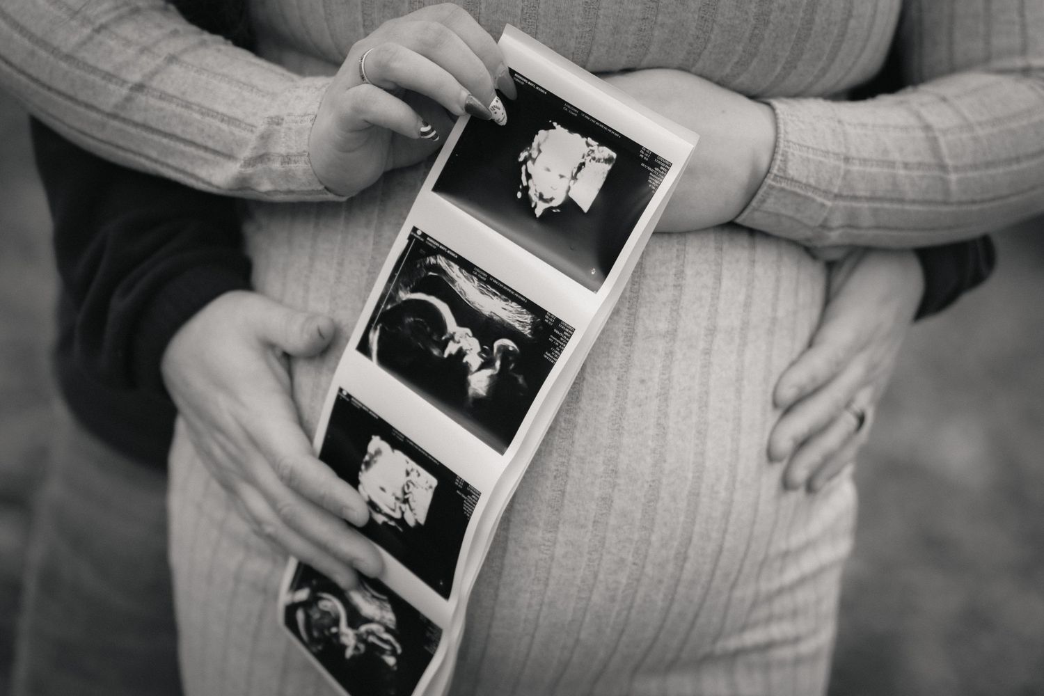 A series of black and white ultrasound images being held in hands showing different stages of fetal development.