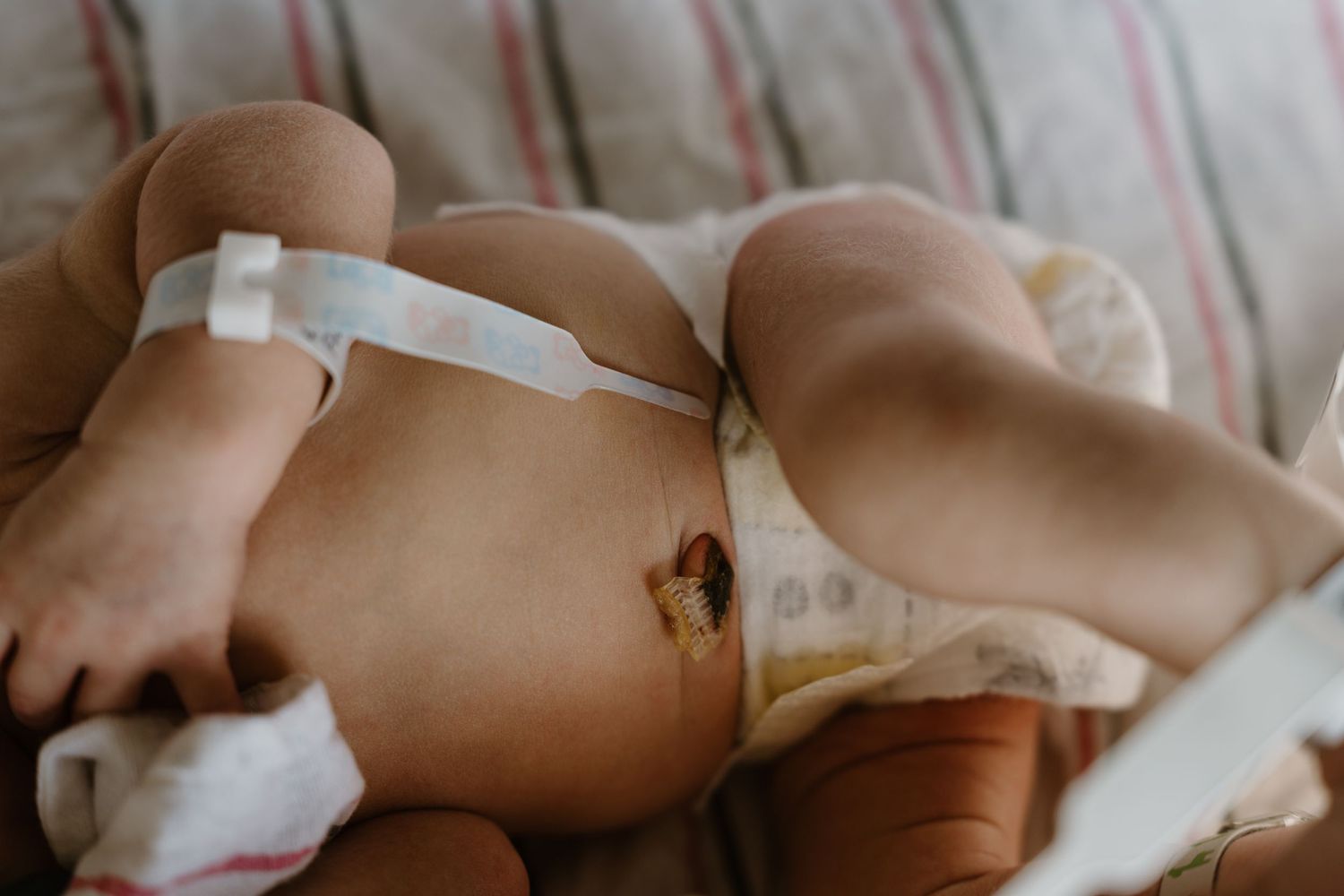Close-up of babywith umbilical cord stump during Fresh 48 in-hospital newborn photography session North Central Indiana