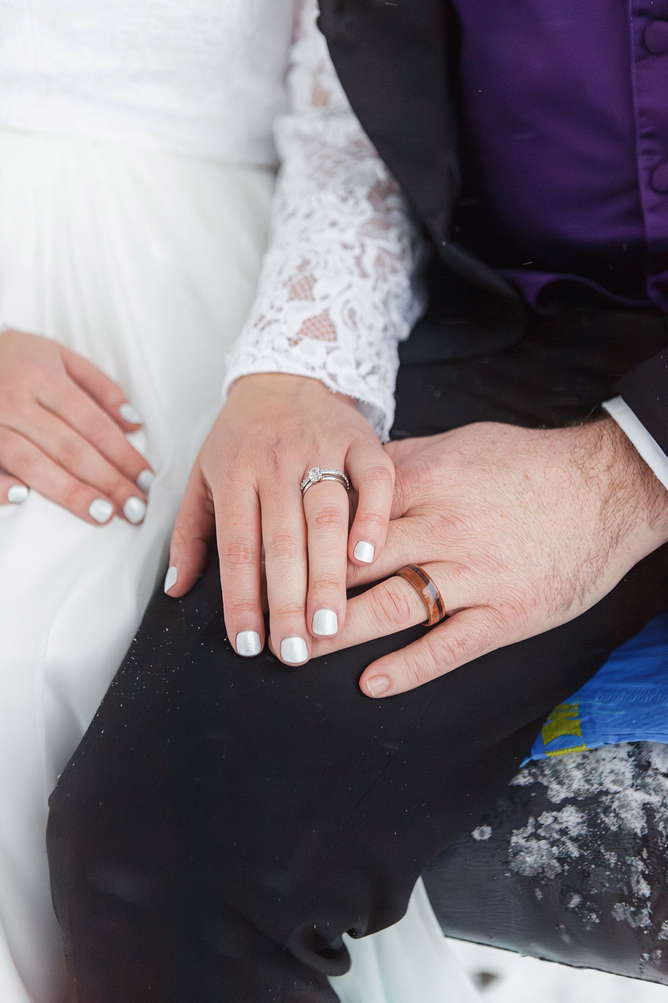 Close-up view of hands with wedding rings resting together on a white and dark fabric surface.
