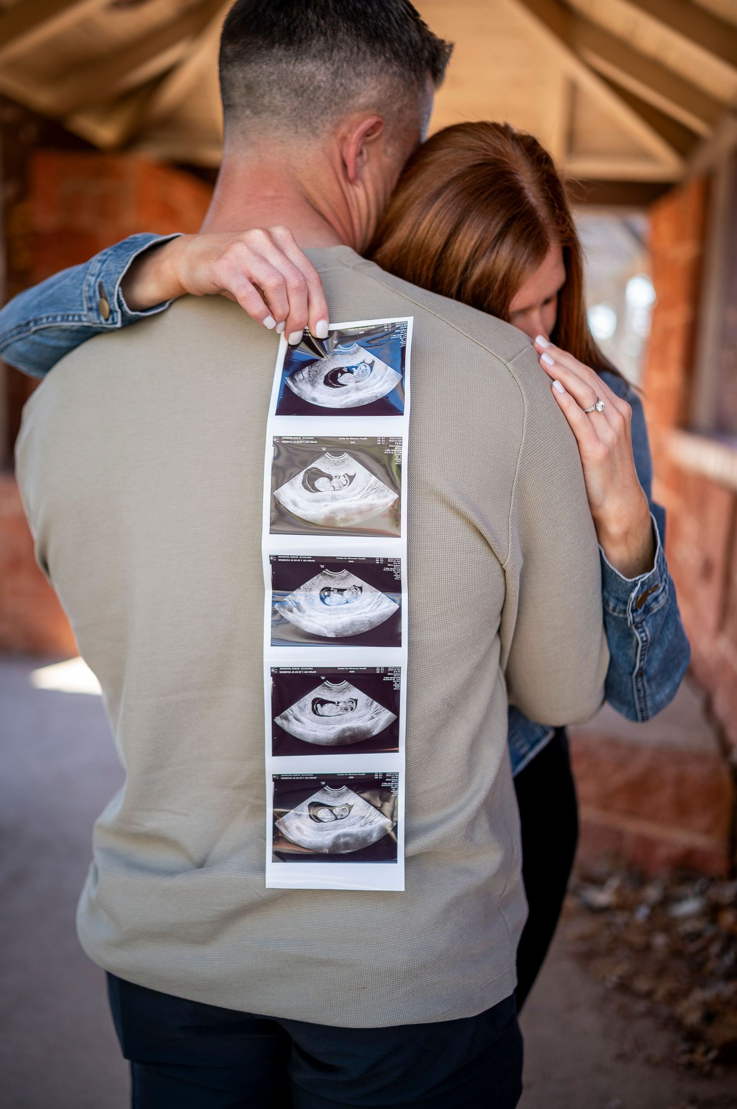 A creative pregnancy announcement featuring ultrasound photos displayed on someone's back.