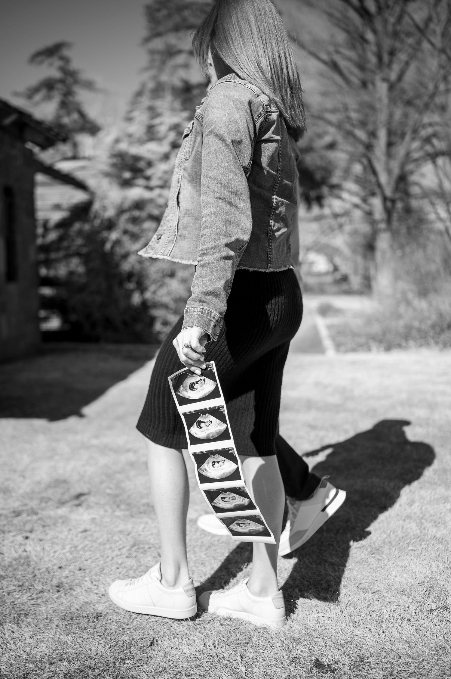 Black and white image of someone wearing ultrasound photos on their leg in an outdoor setting.