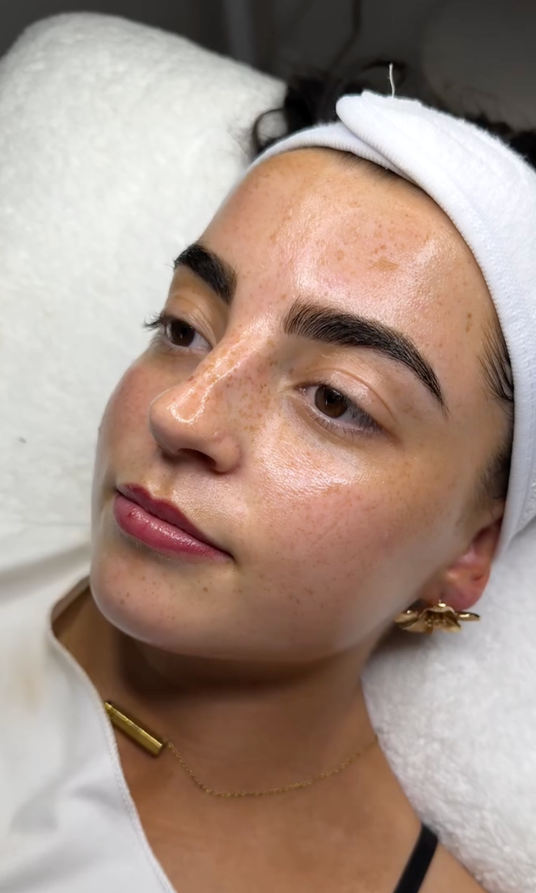 Close-up profile view of a person receiving a facial skincare treatment on a white spa bed.