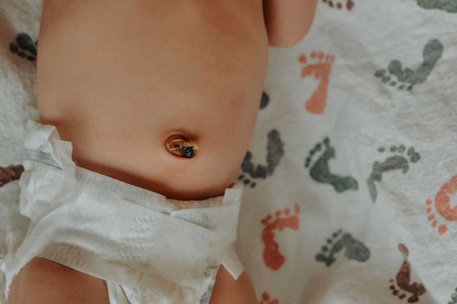 Close-up of a newborn baby's belly button with umbilical cord clamp, wearing a diaper on a patterned blanket.