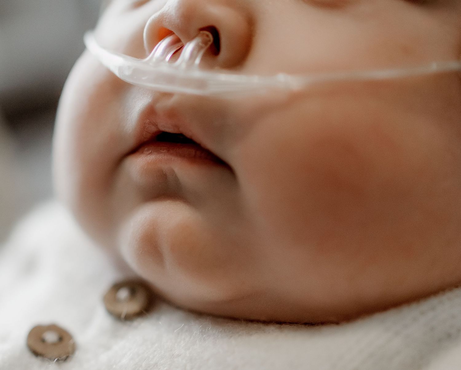 Close-up of a newborn baby with a nasal cannula oxygen tube, wearing a white outfit with button details.