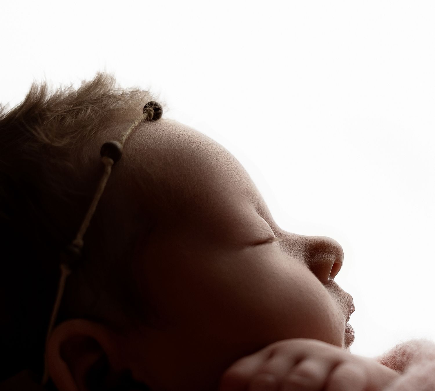 Newborn baby sleeping peacefully in profile view, wearing a small hearing aid device on their ear.