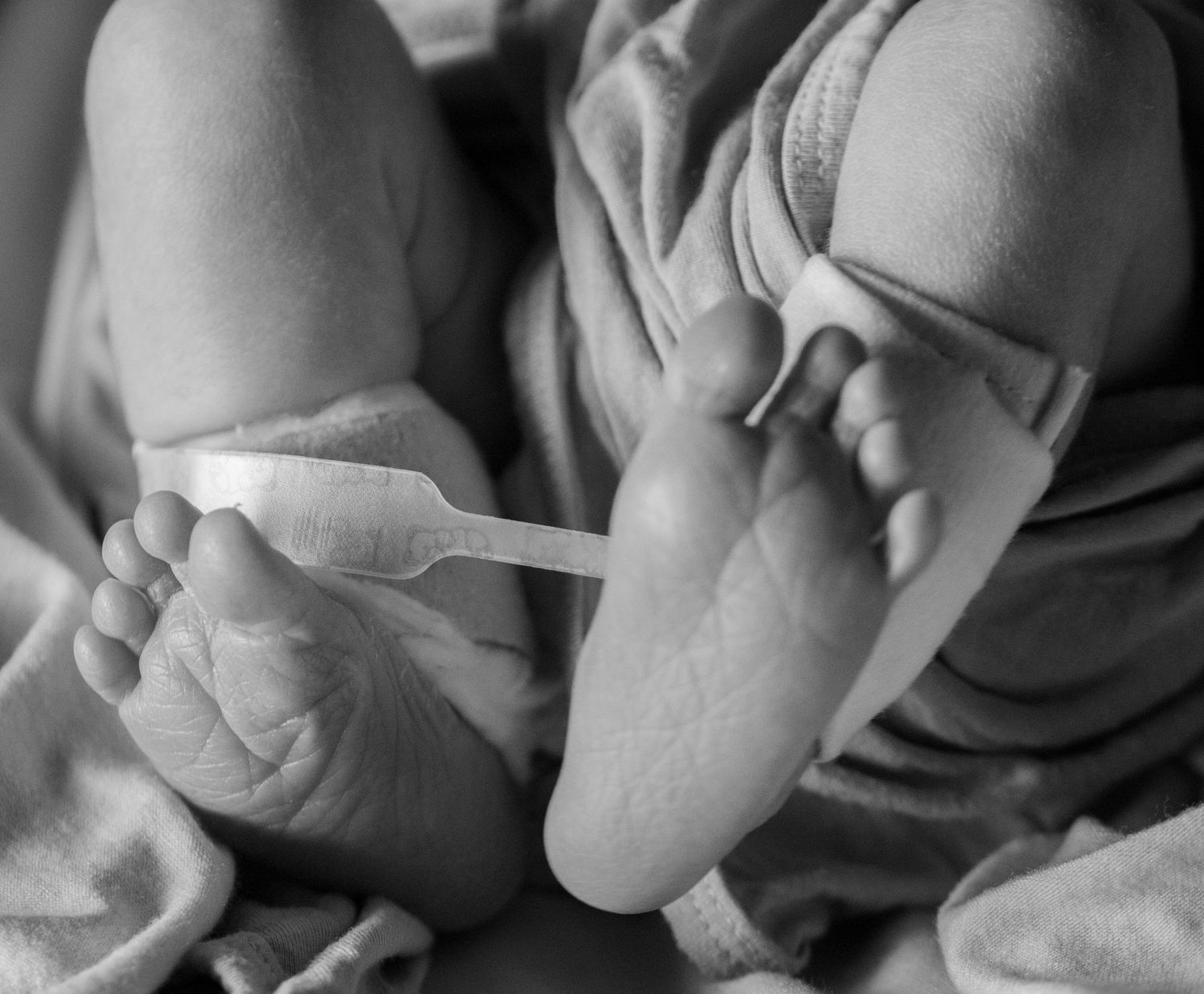 Black and white photo of newborn baby feet with hospital ID band attached.